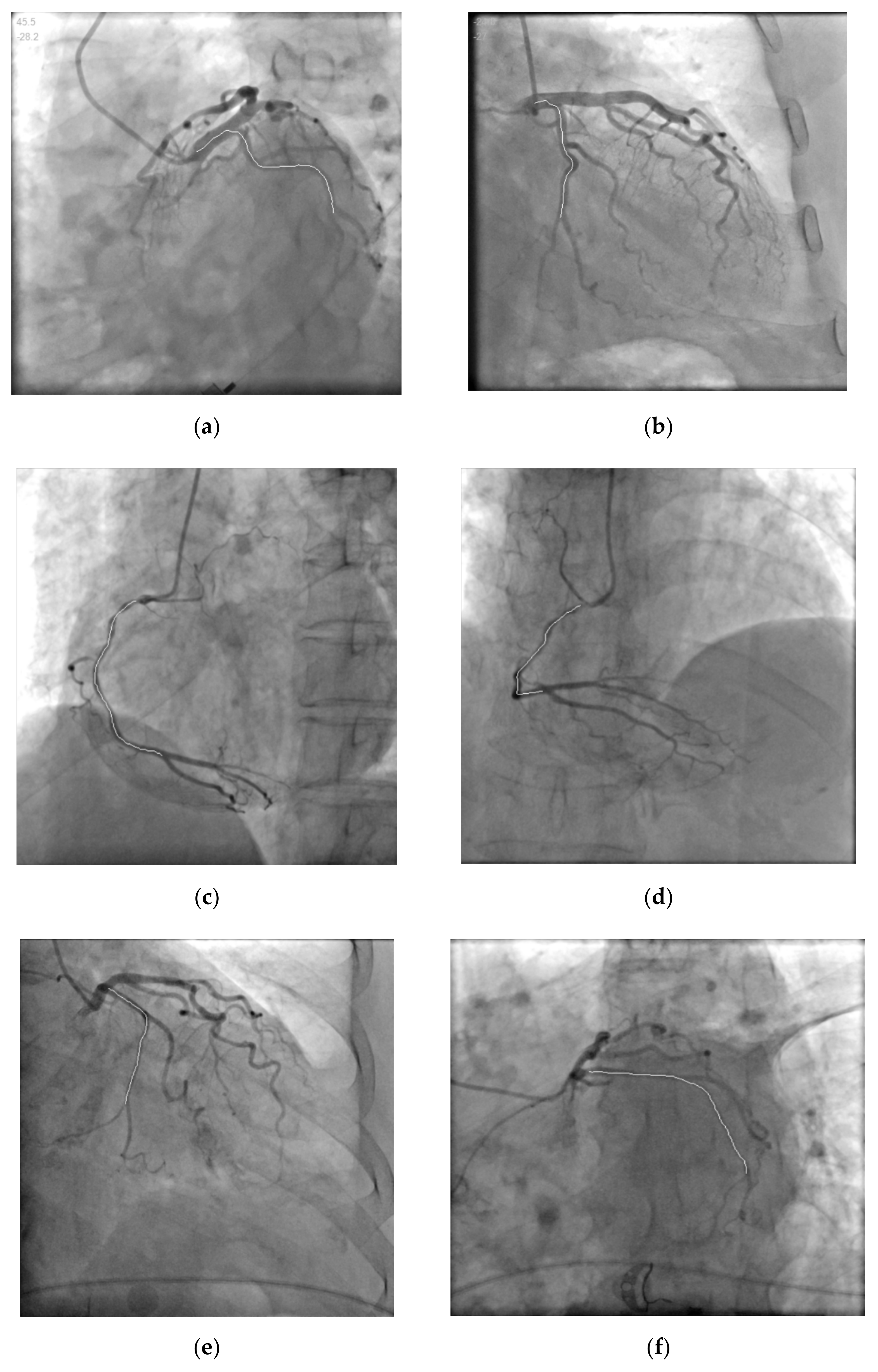 Information 13 00038 g007