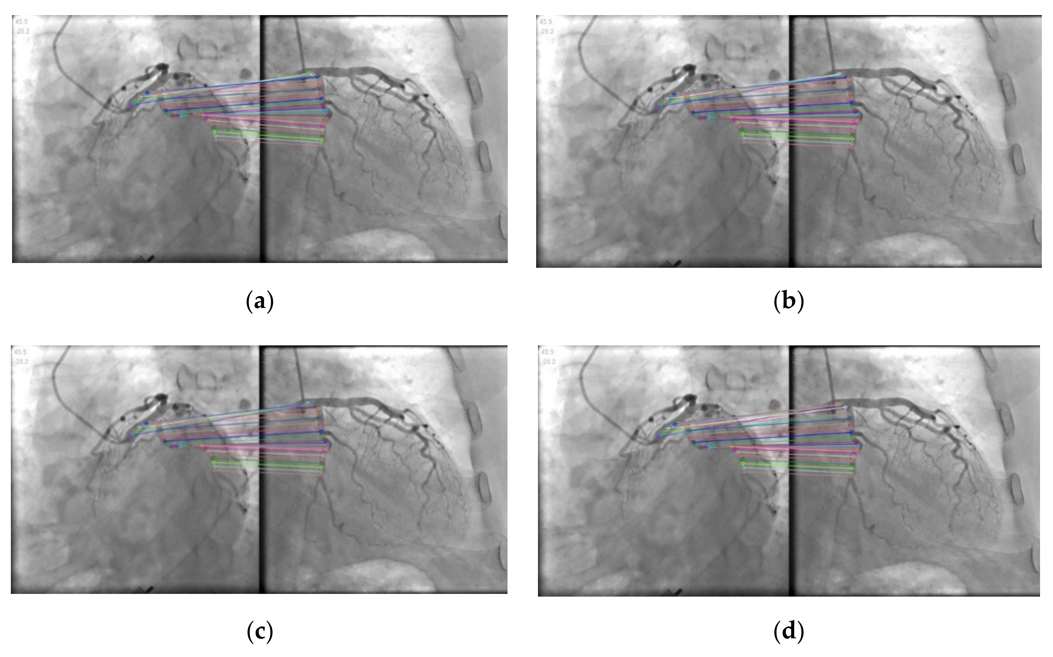 Information 13 00038 g008