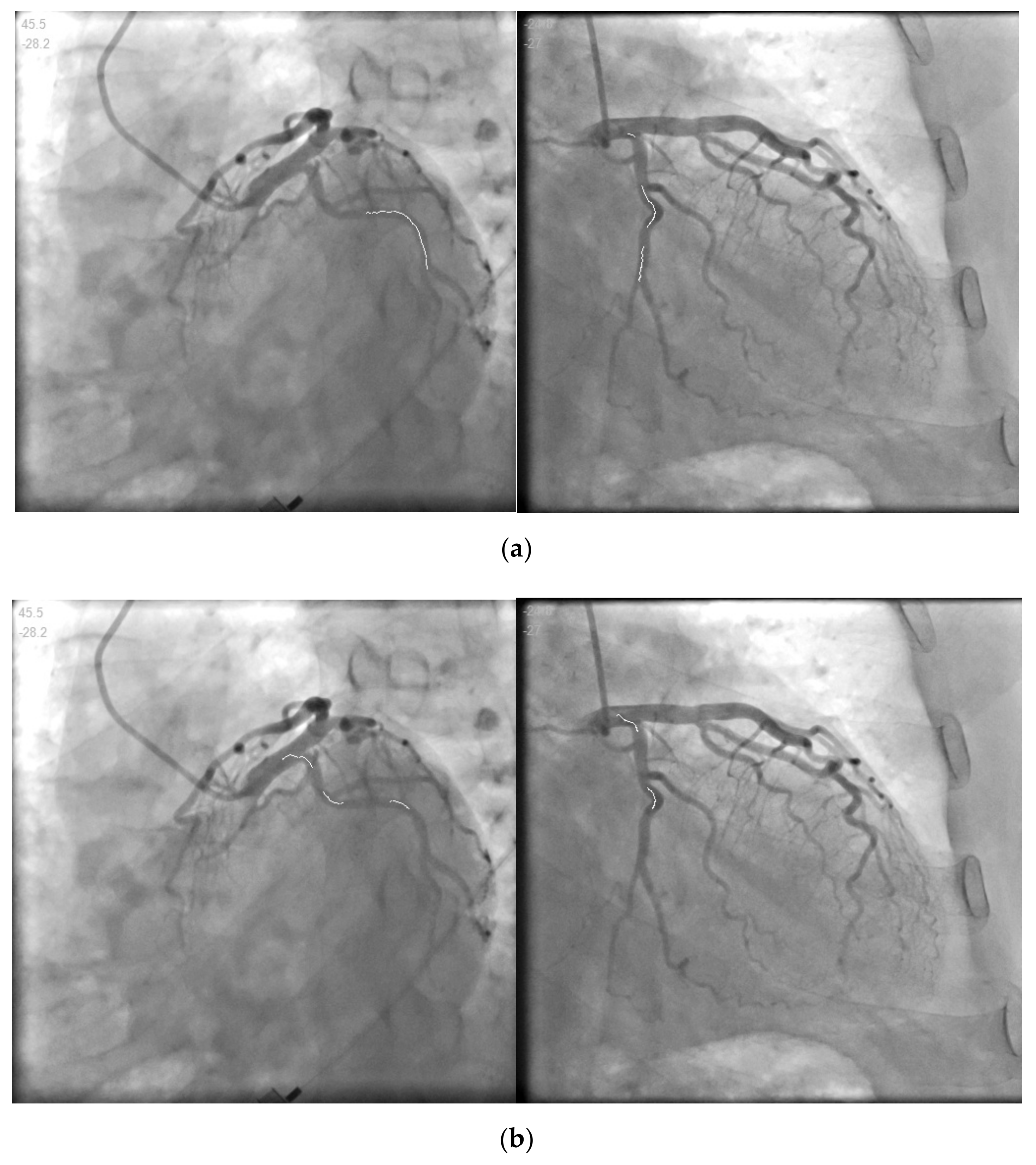 Information 13 00038 g009a