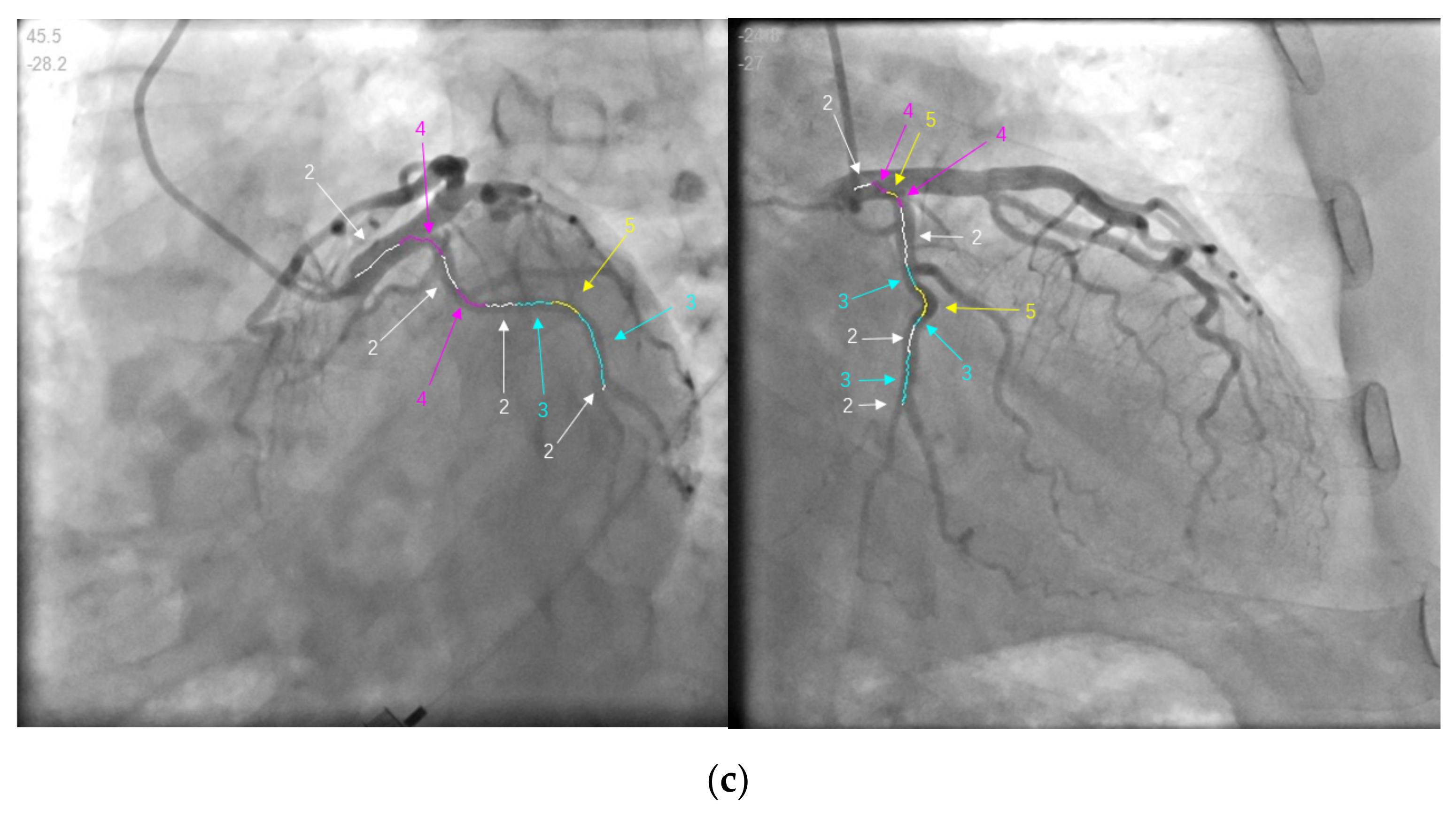 Information 13 00038 g009b