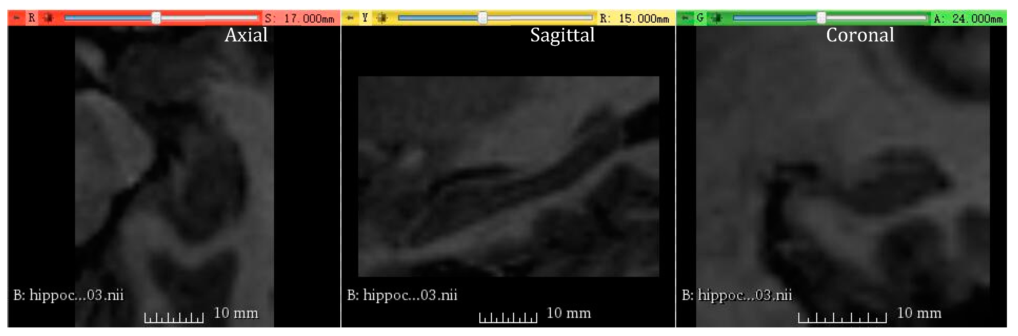 Information 14 00190 g006