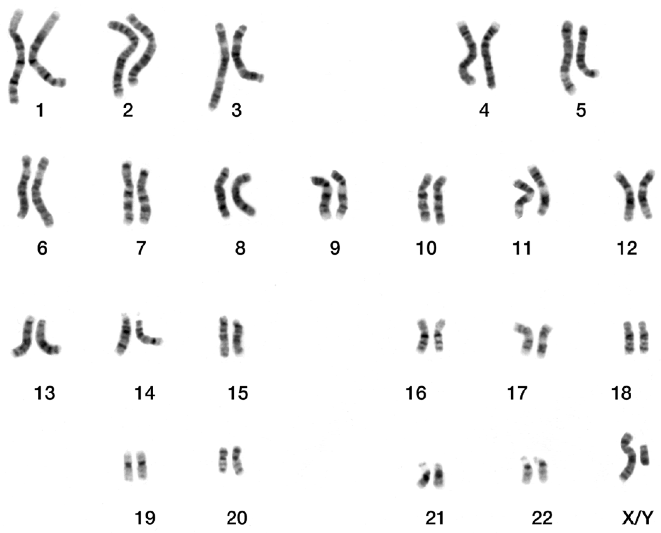 Ancestry blocks for canine chromosome 6. Each horizontal band is an