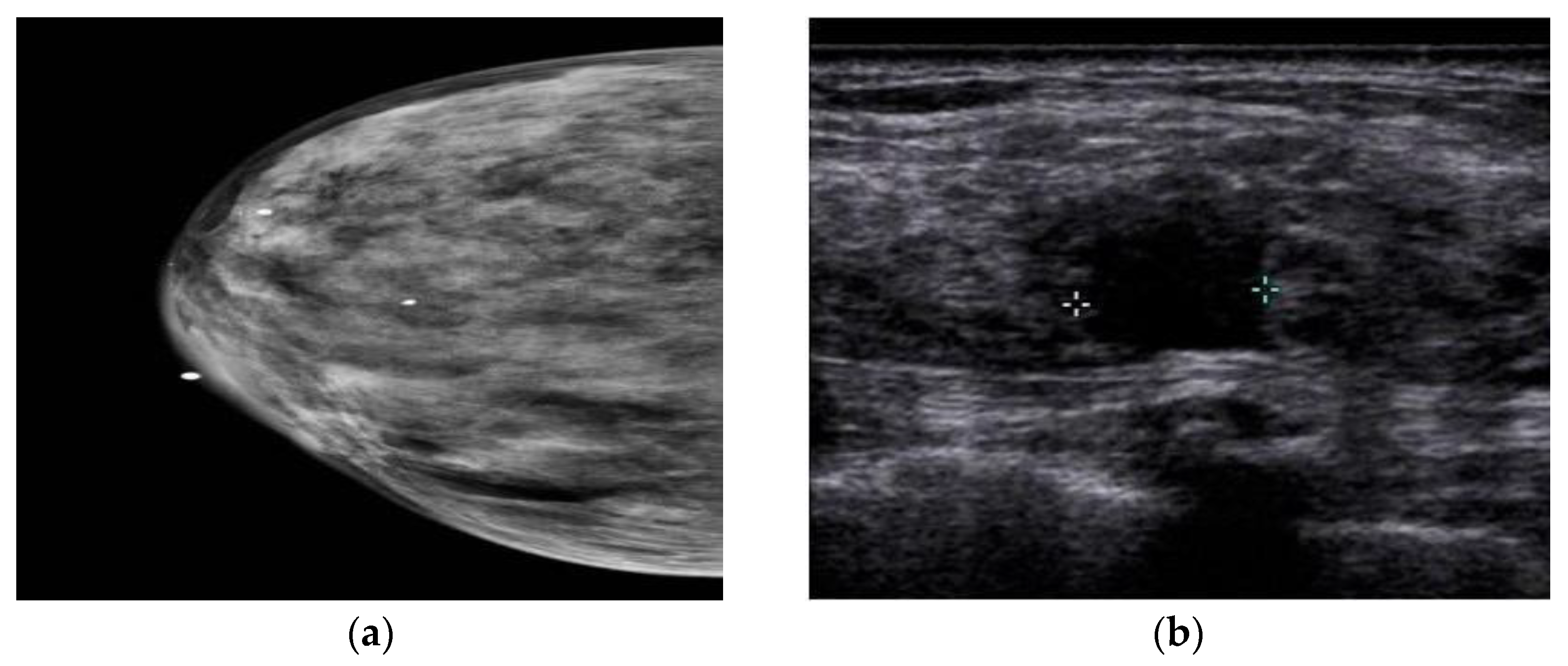 Information 15 00010 g004