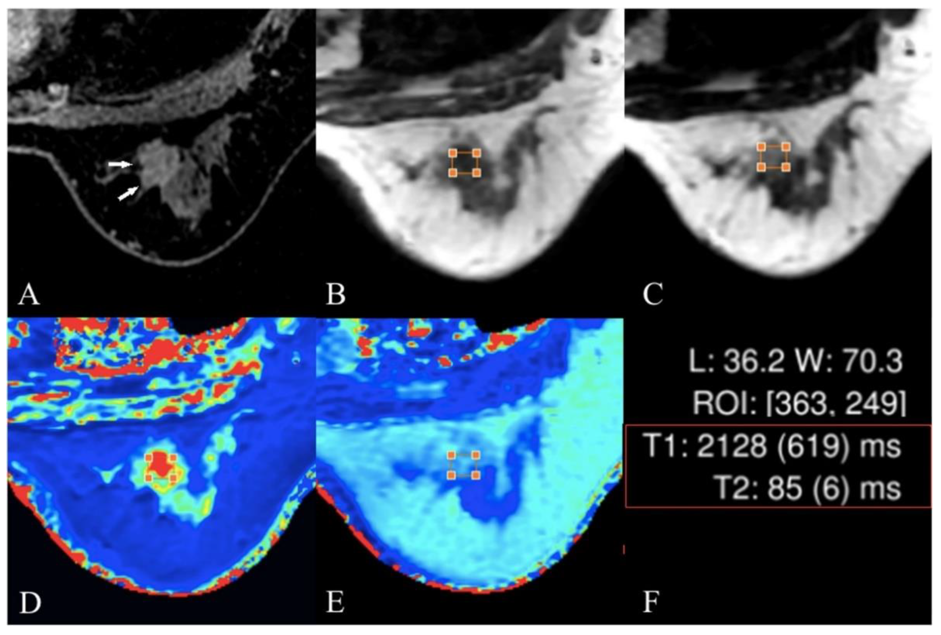 Information 15 00010 g005