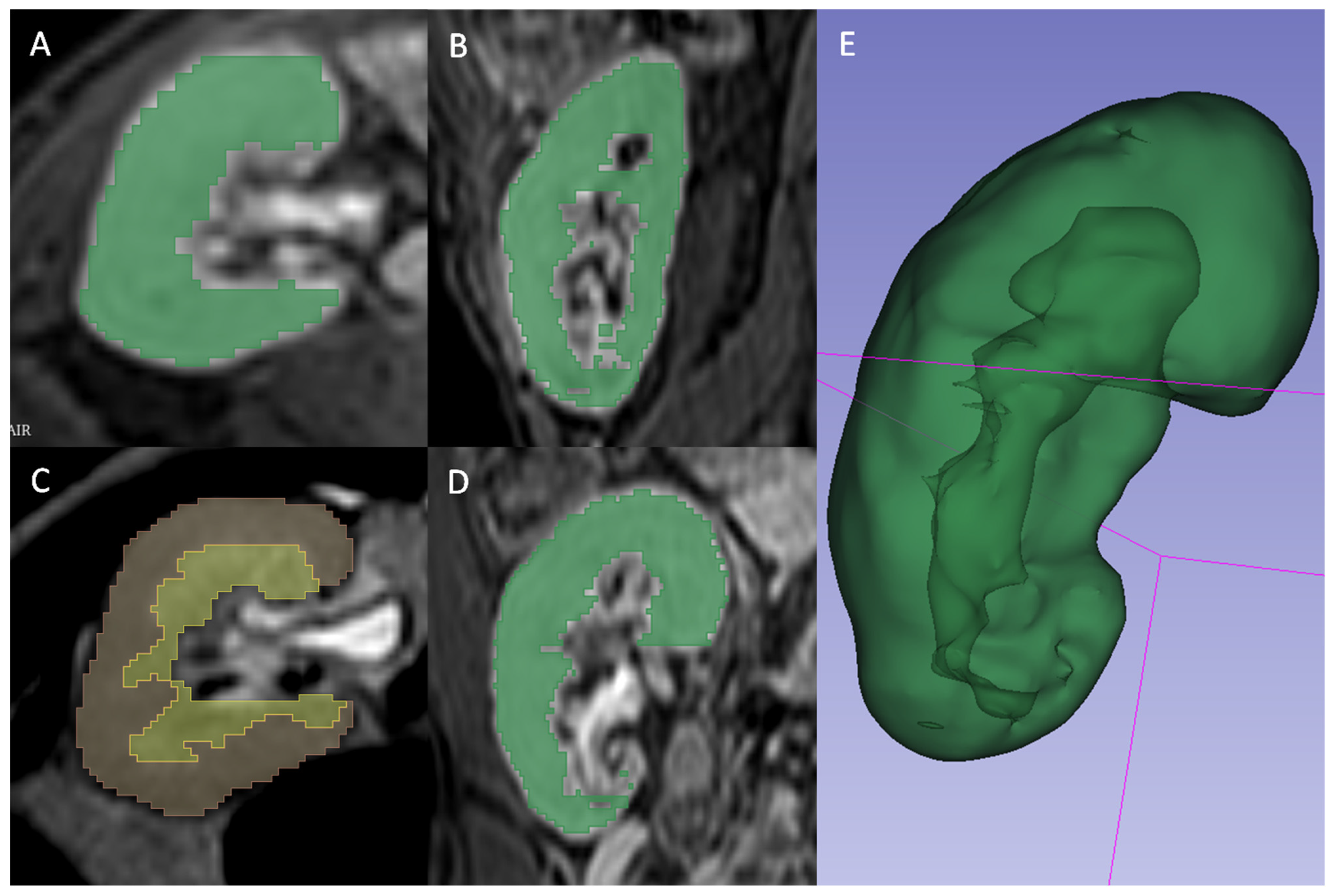 Information 15 00537 g002