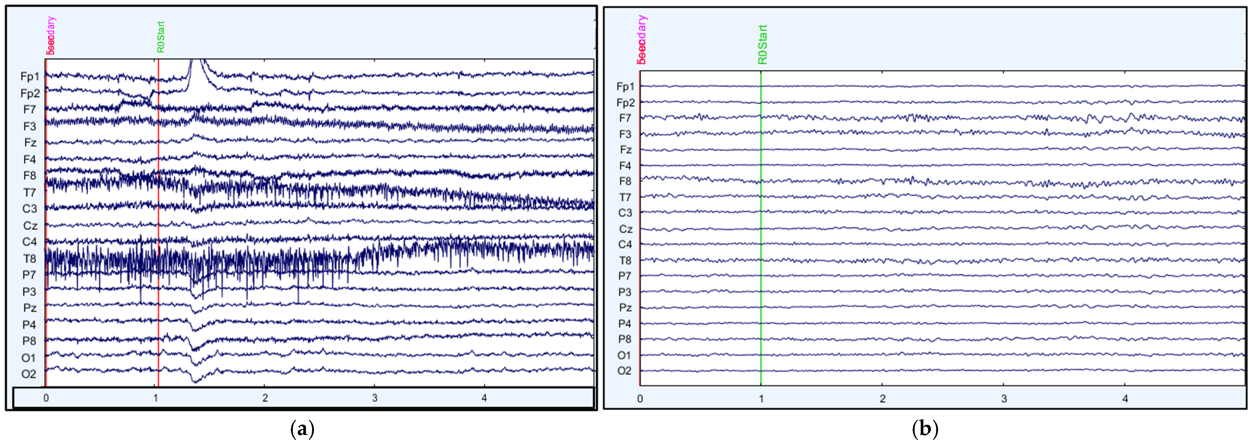 Information 15 00640 g004