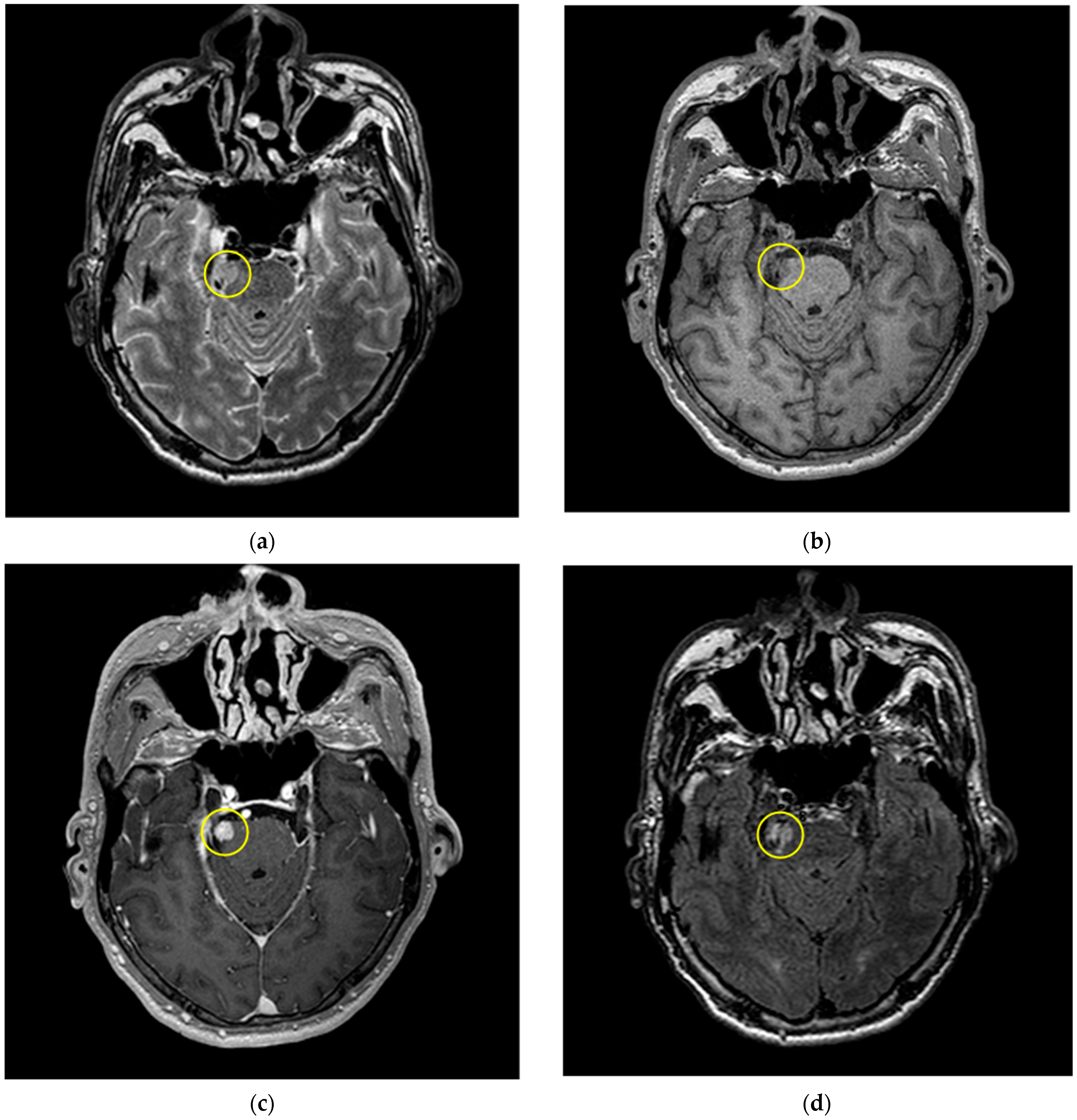 Information 16 00188 g001a