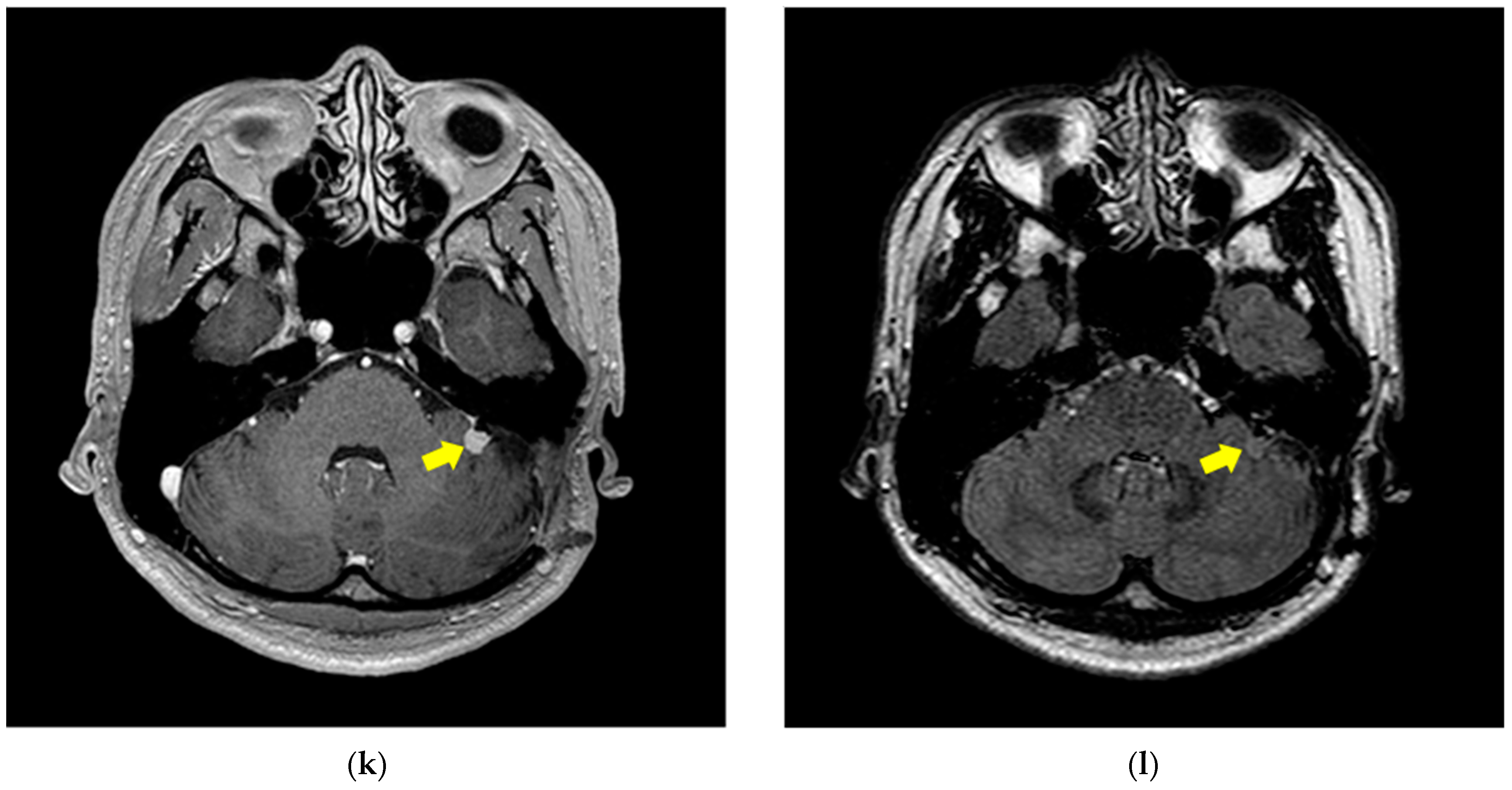 Information 16 00188 g001c