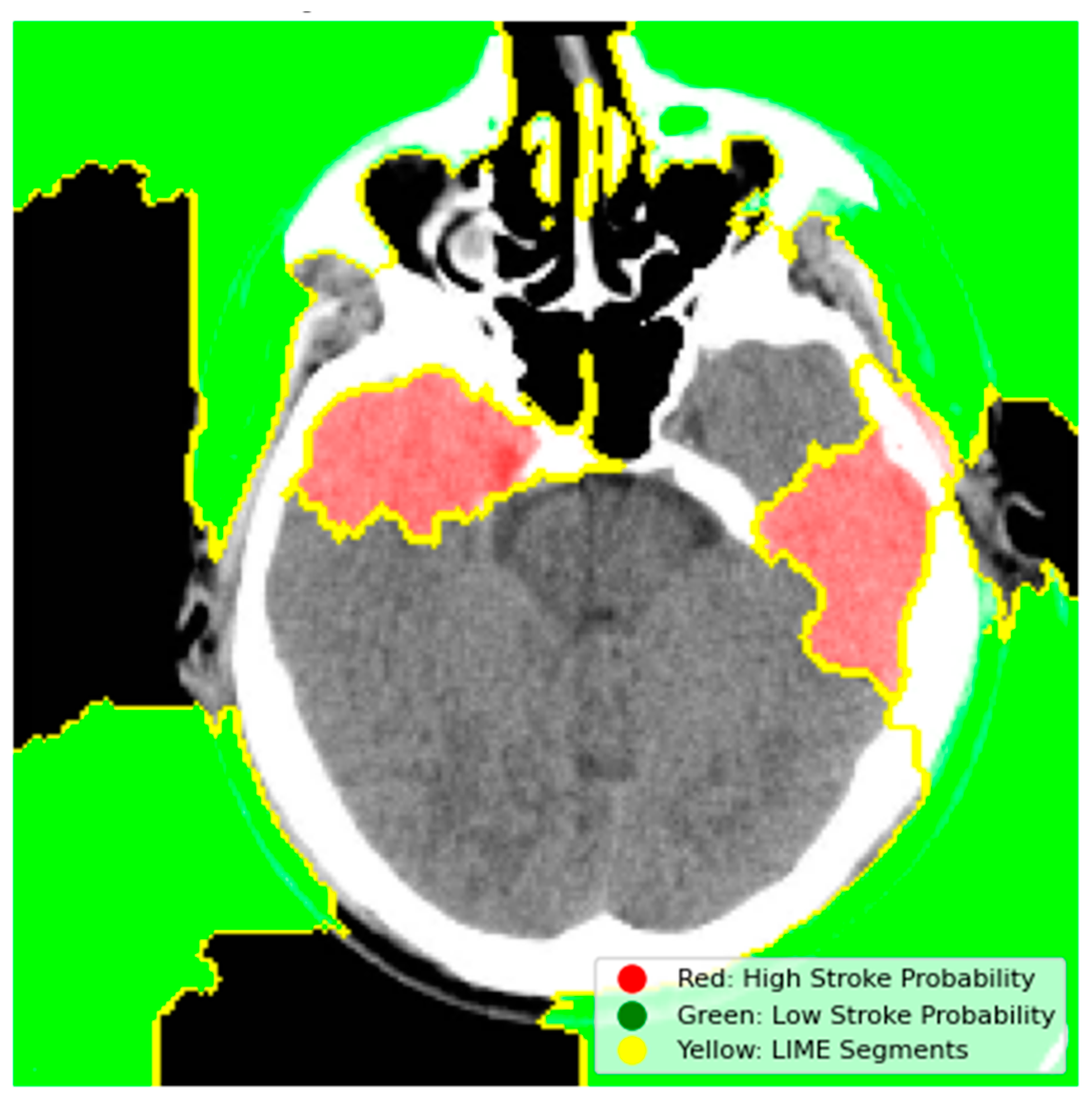 Information 16 00345 g007