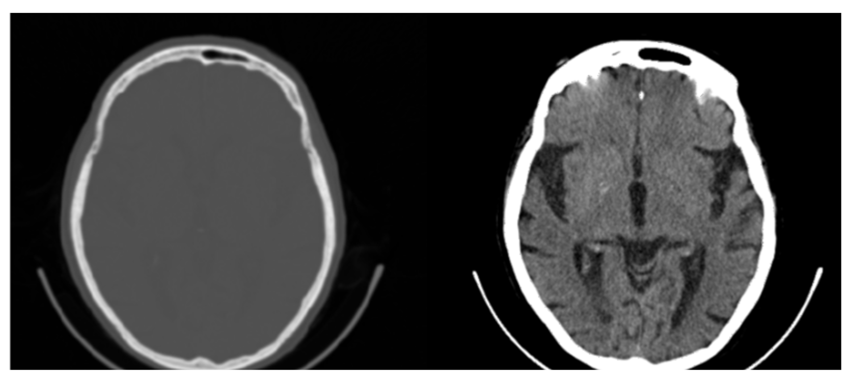 Information 16 00352 g004