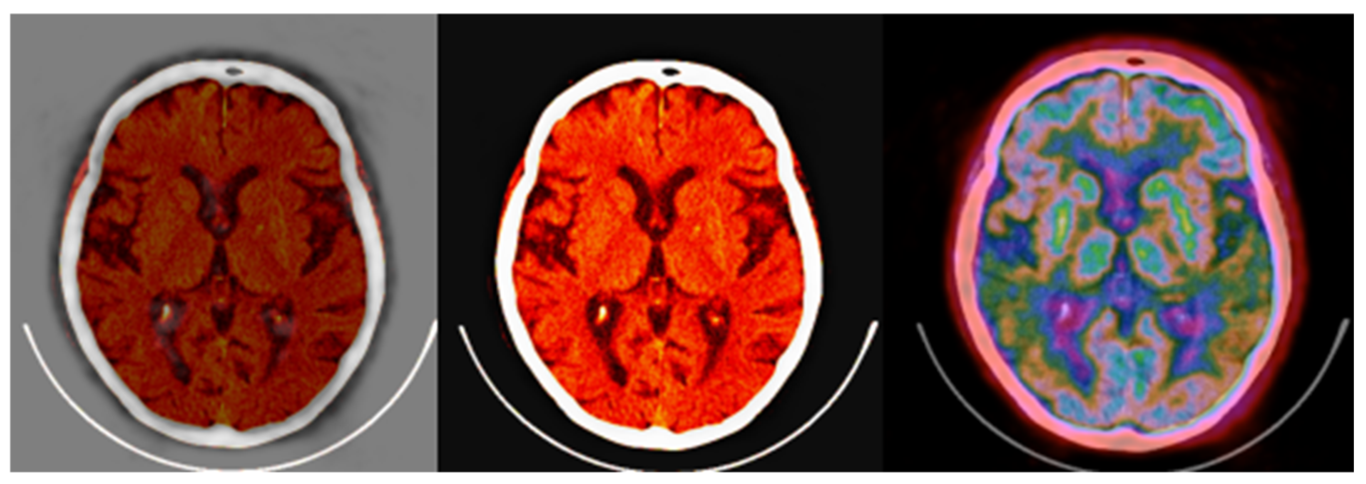 Information 16 00352 g015