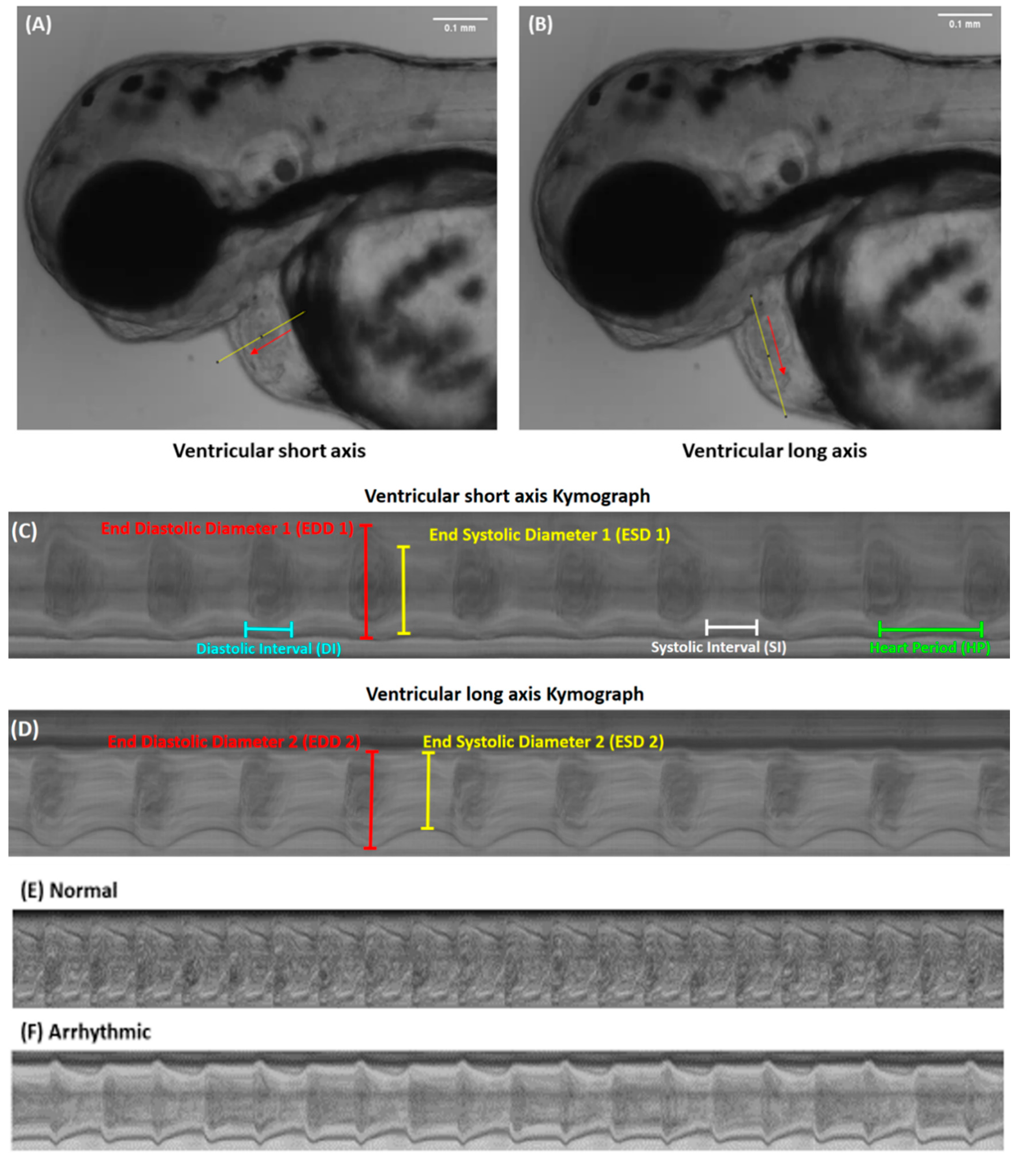 Inventions 06 00008 g002 Inventions 06 00008 g002