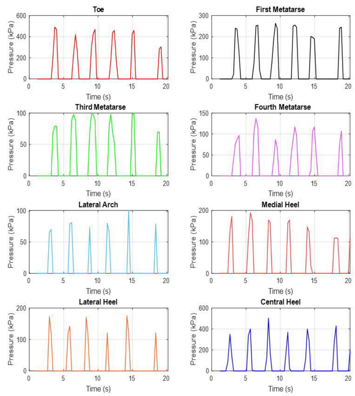 Inventions 07 00051 g011 Inventions 07 00051 g011