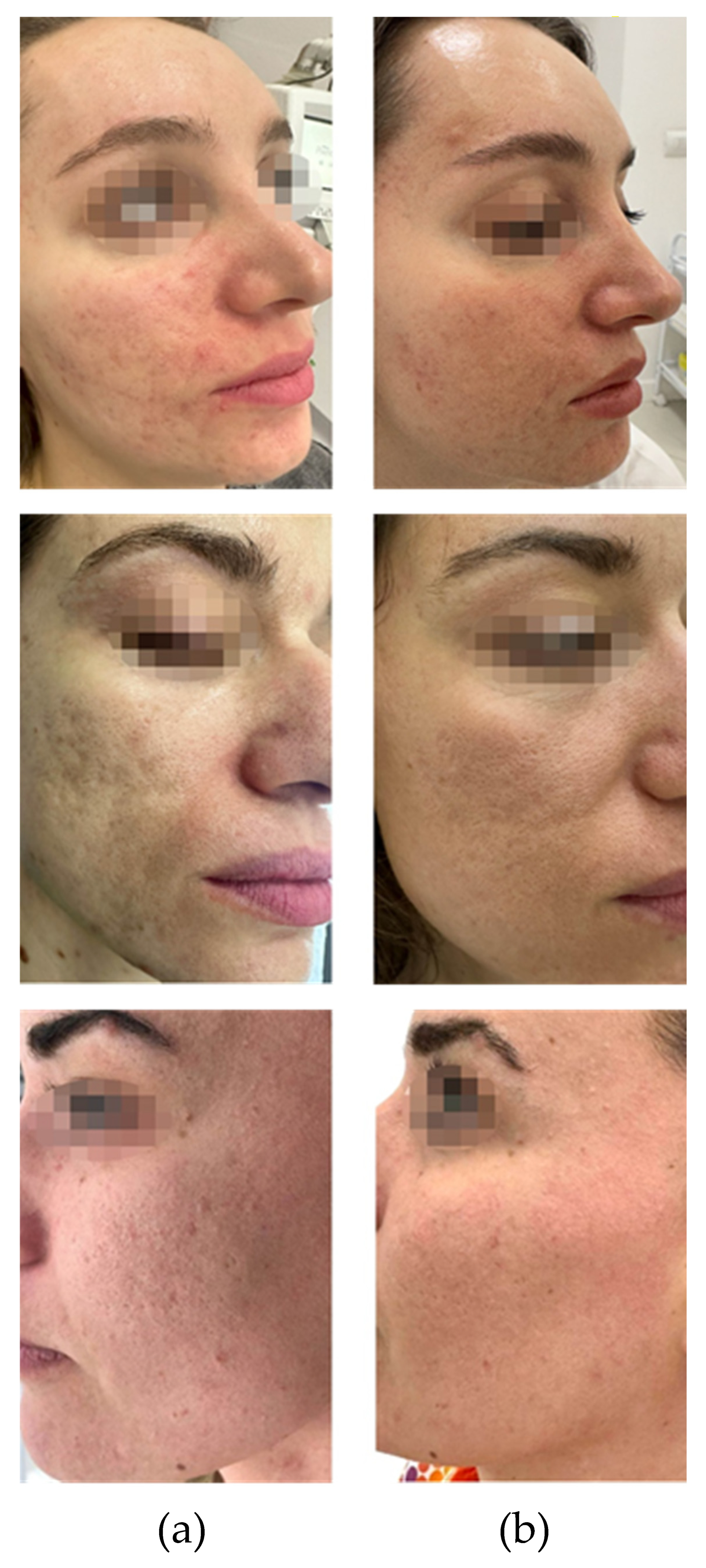 Jaestheticmed 01 00002 g001