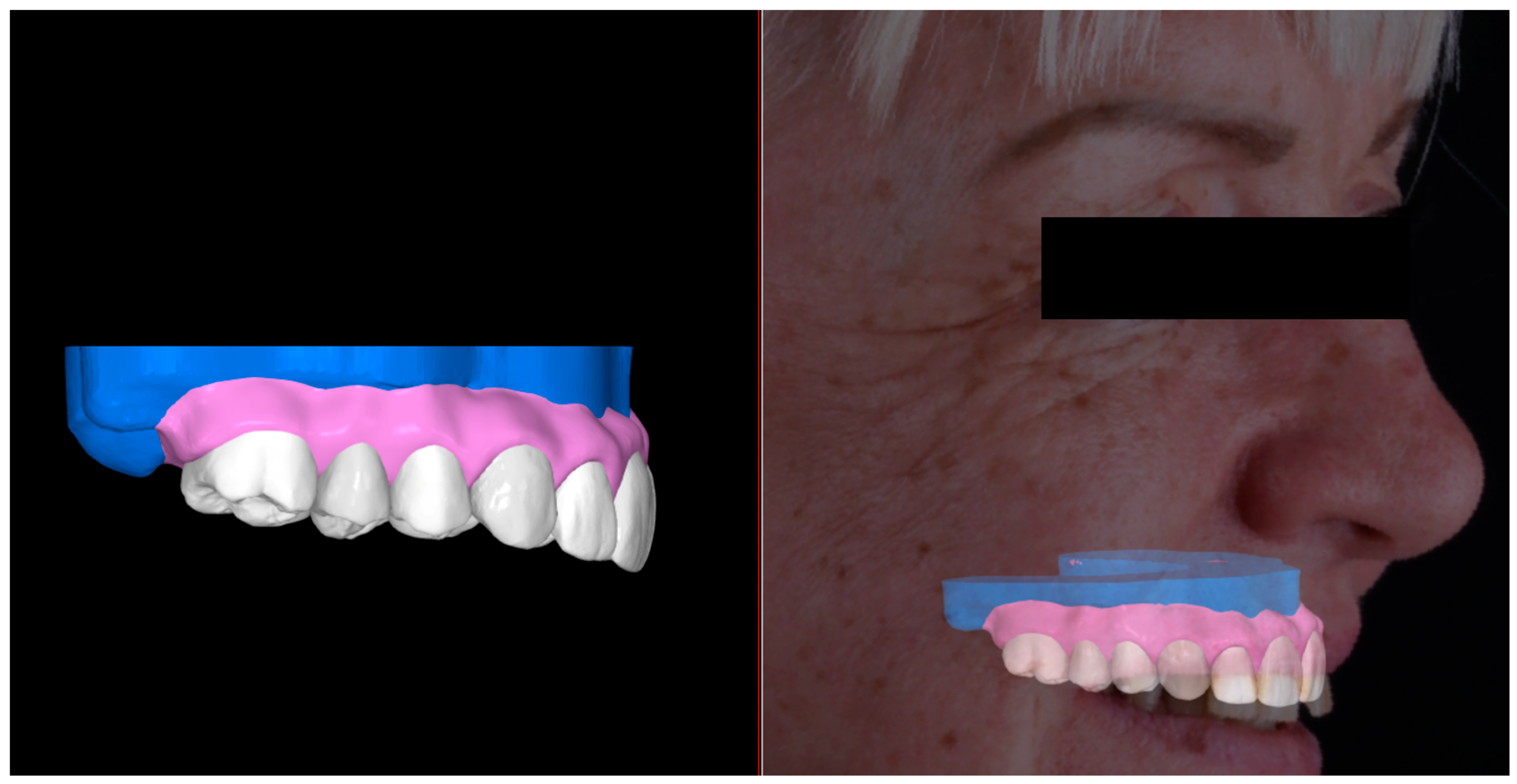 Jaestheticmed 01 00004 g003