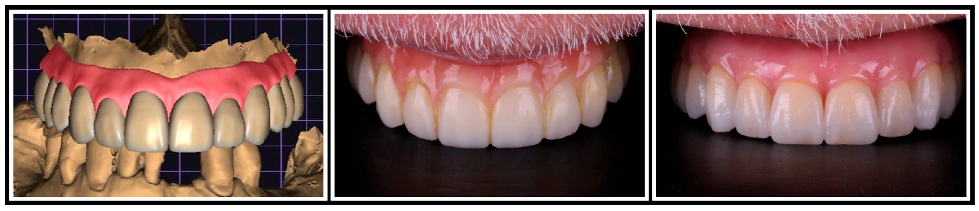 Jaestheticmed 01 00004 g008