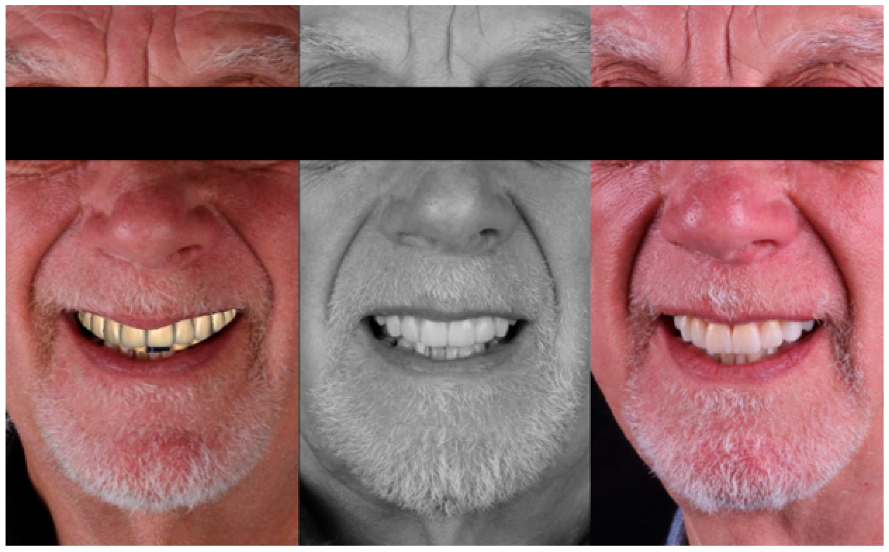 Jaestheticmed 01 00004 g009