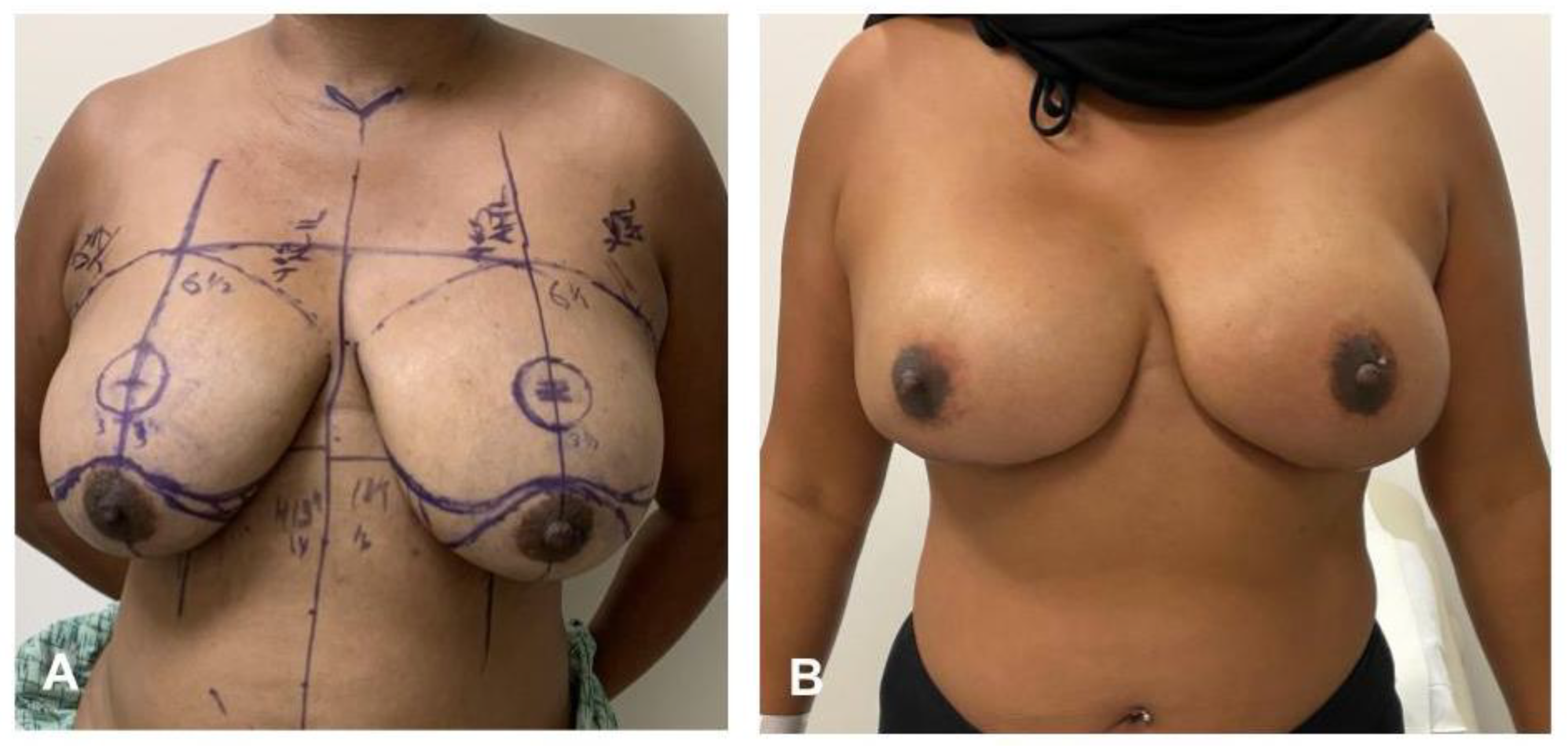 Jaestheticmed 01 00011 g003