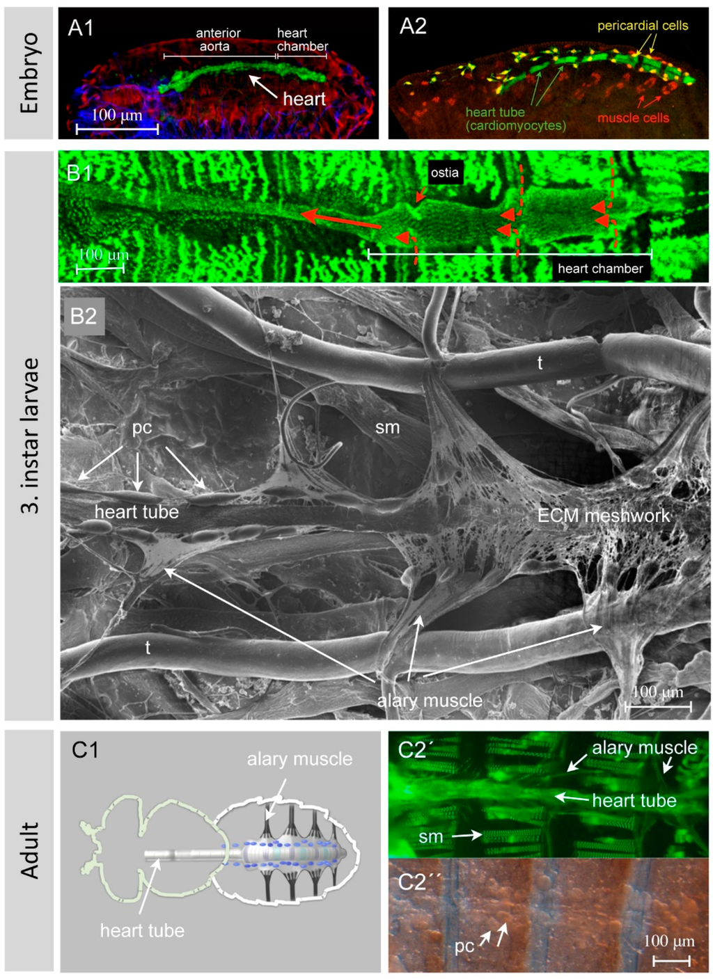 JCDD | Free Full-Text | On the Morphology of the Drosophila Heart | HTML