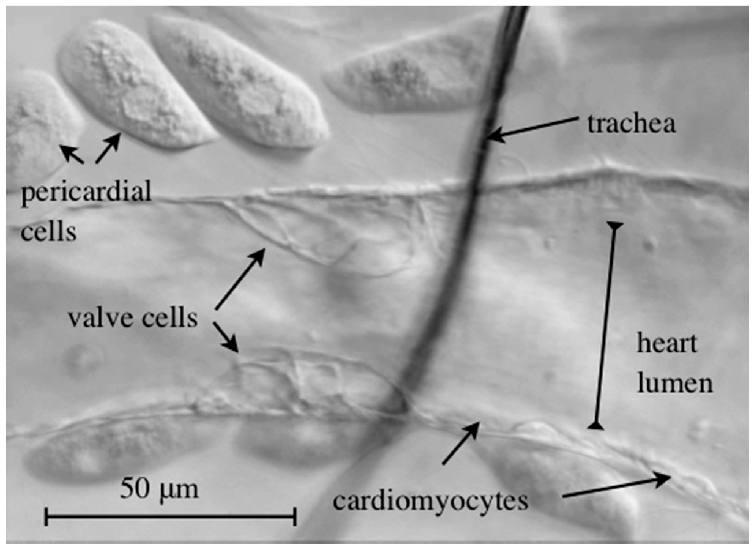 JCDD | Free Full-Text | On the Morphology of the Drosophila Heart