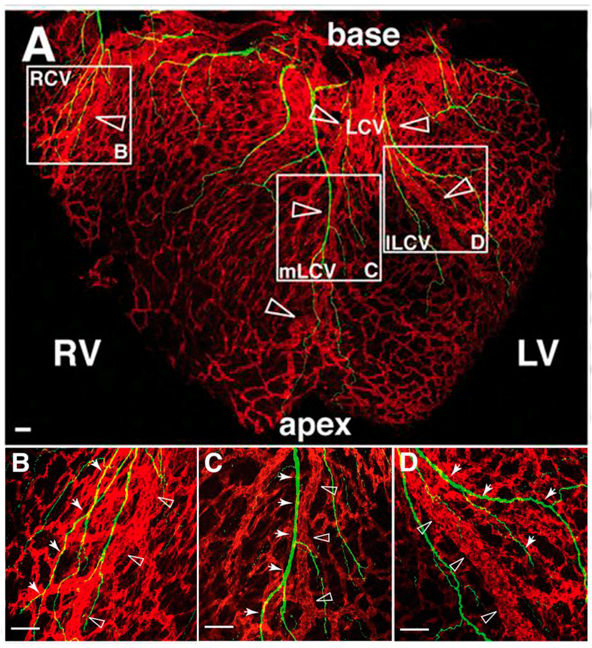 Jcdd 03 00028 g007 JCDD | Free Full-Text | Part and Parcel of the Cardiac Autonomic ...