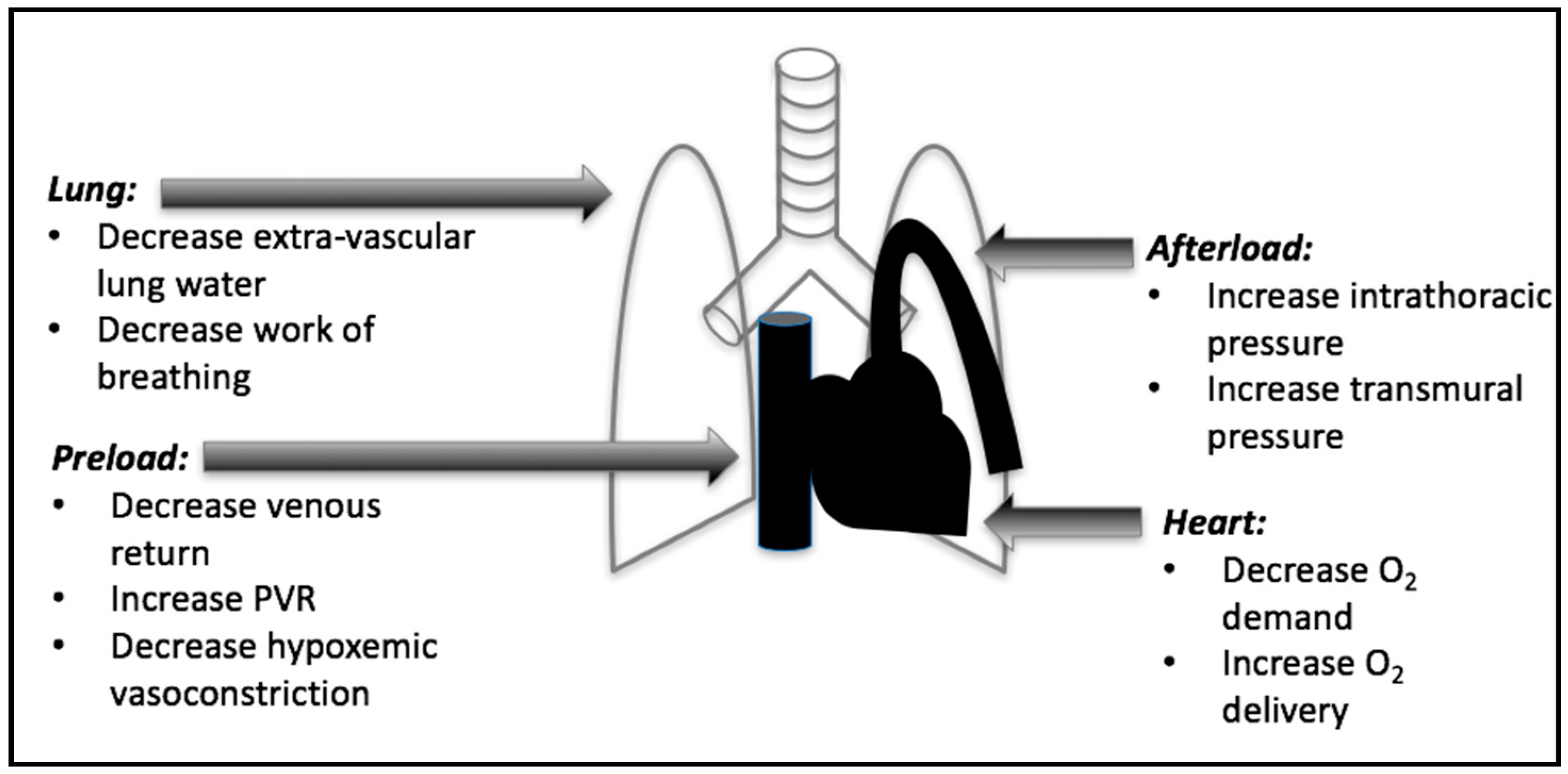 How does mechanical ventilation work during an operation?