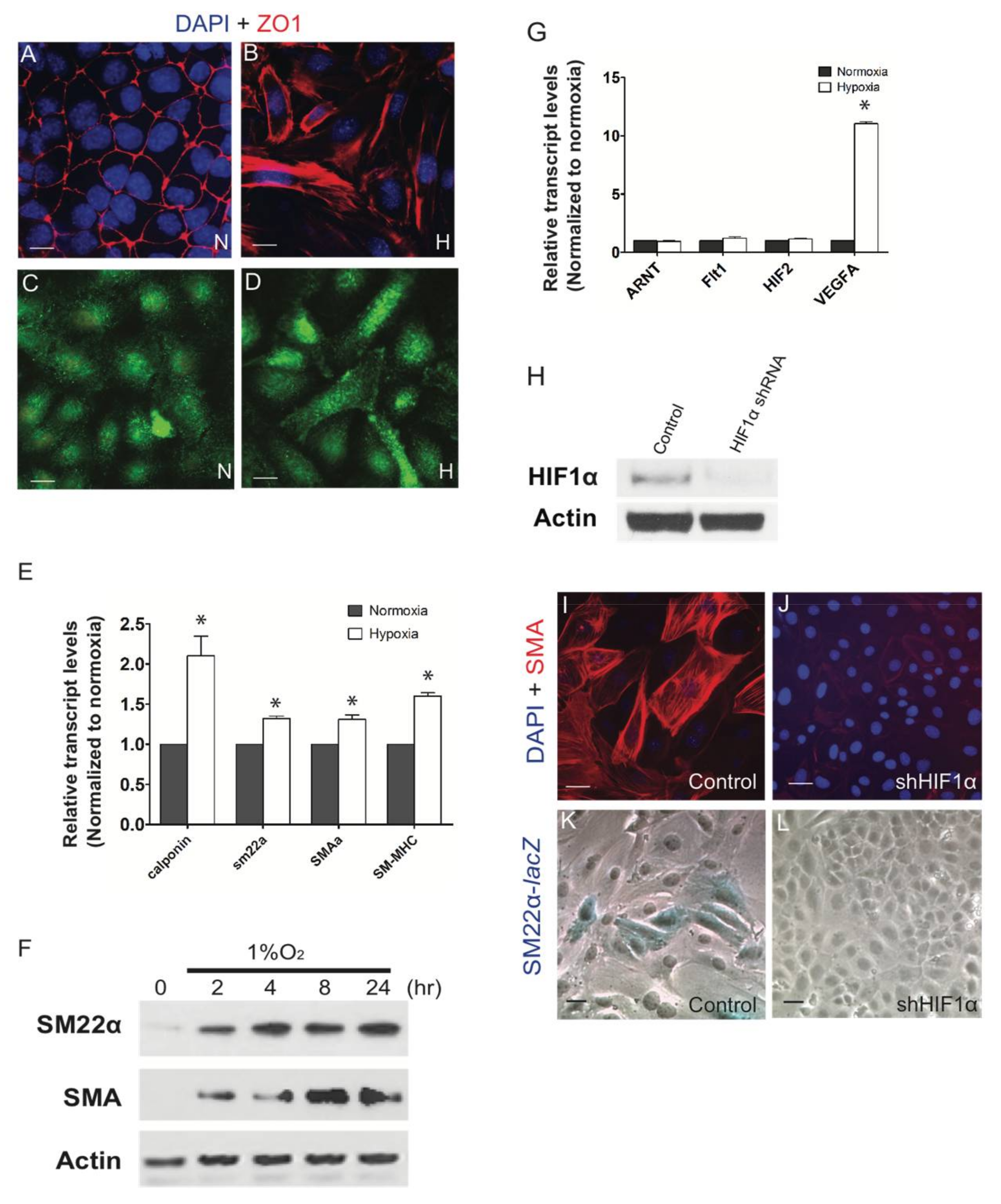 JCDD | Free Full-Text | Hypoxia Supports Epicardial Cell