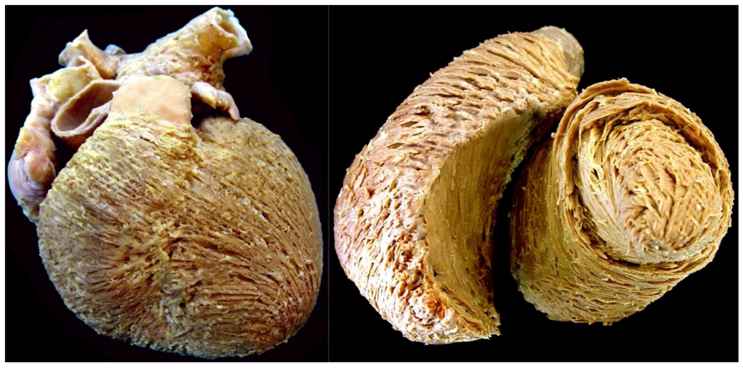 Jcdd 05 00034 g003 Jcdd 05 00034 g003