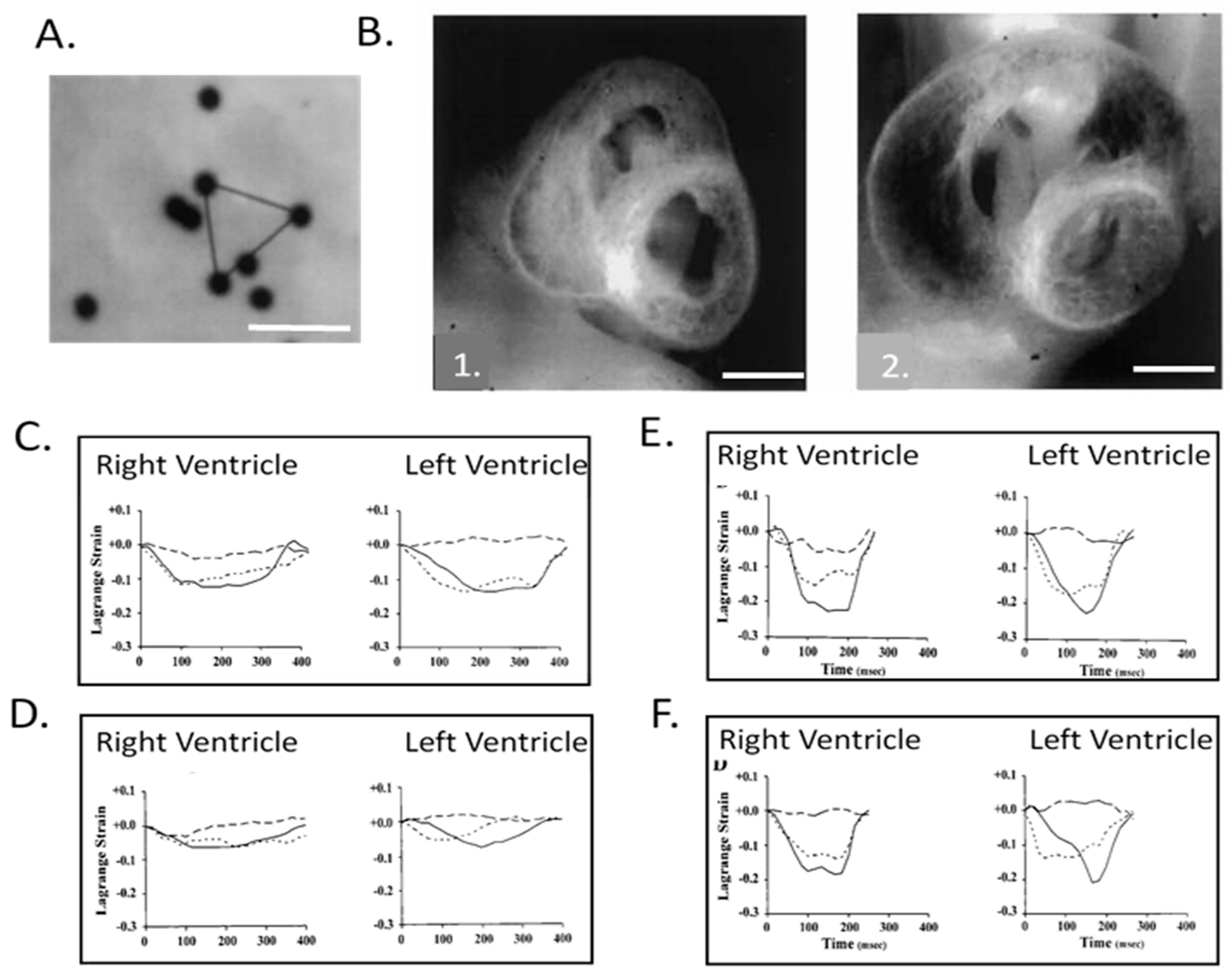 Jcdd 07 00023 g008 Jcdd 07 00023 g008