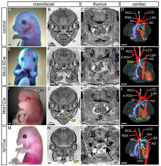 Jcdd Free Full Text Early Embryonic Expression Of Ap 2a Is Critical For Cardiovascular Development Html