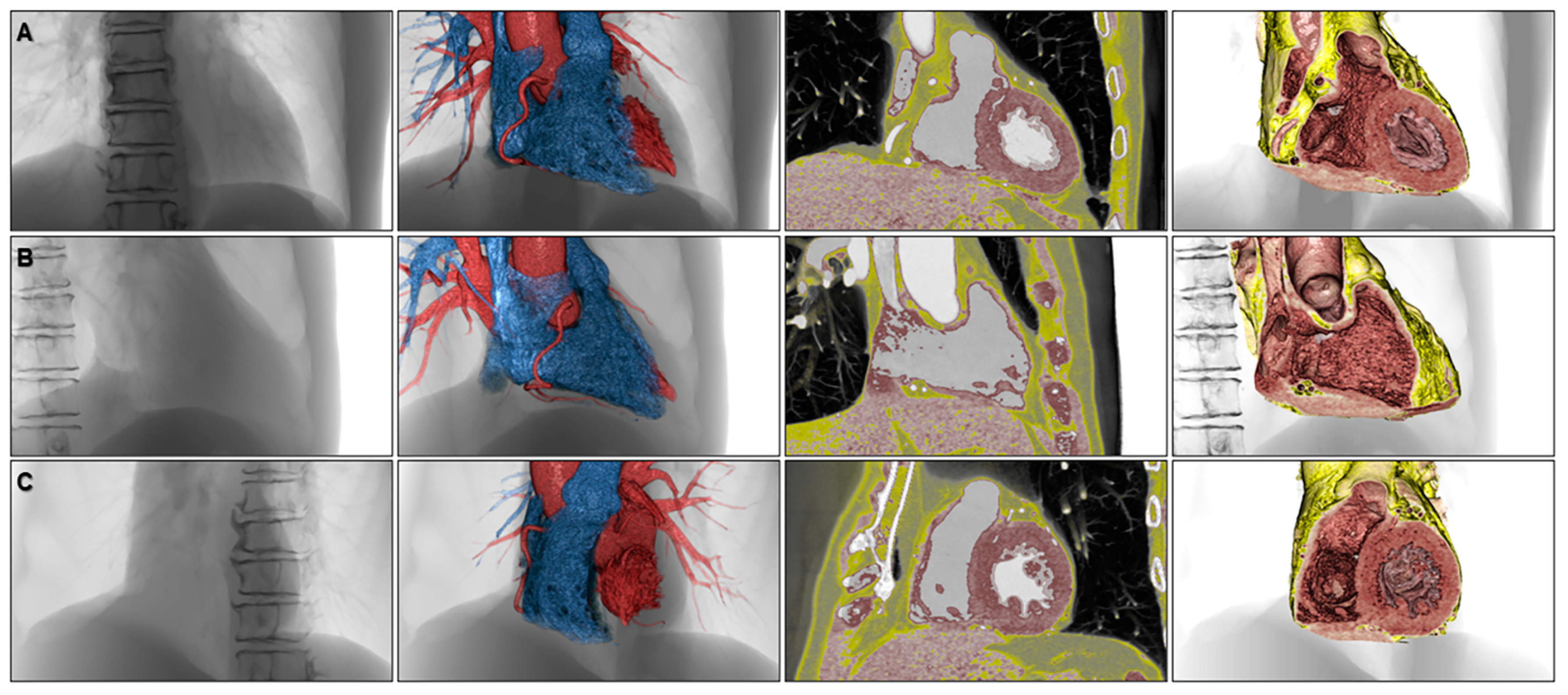 Jcdd 07 00030 g010 Jcdd 07 00030 g010