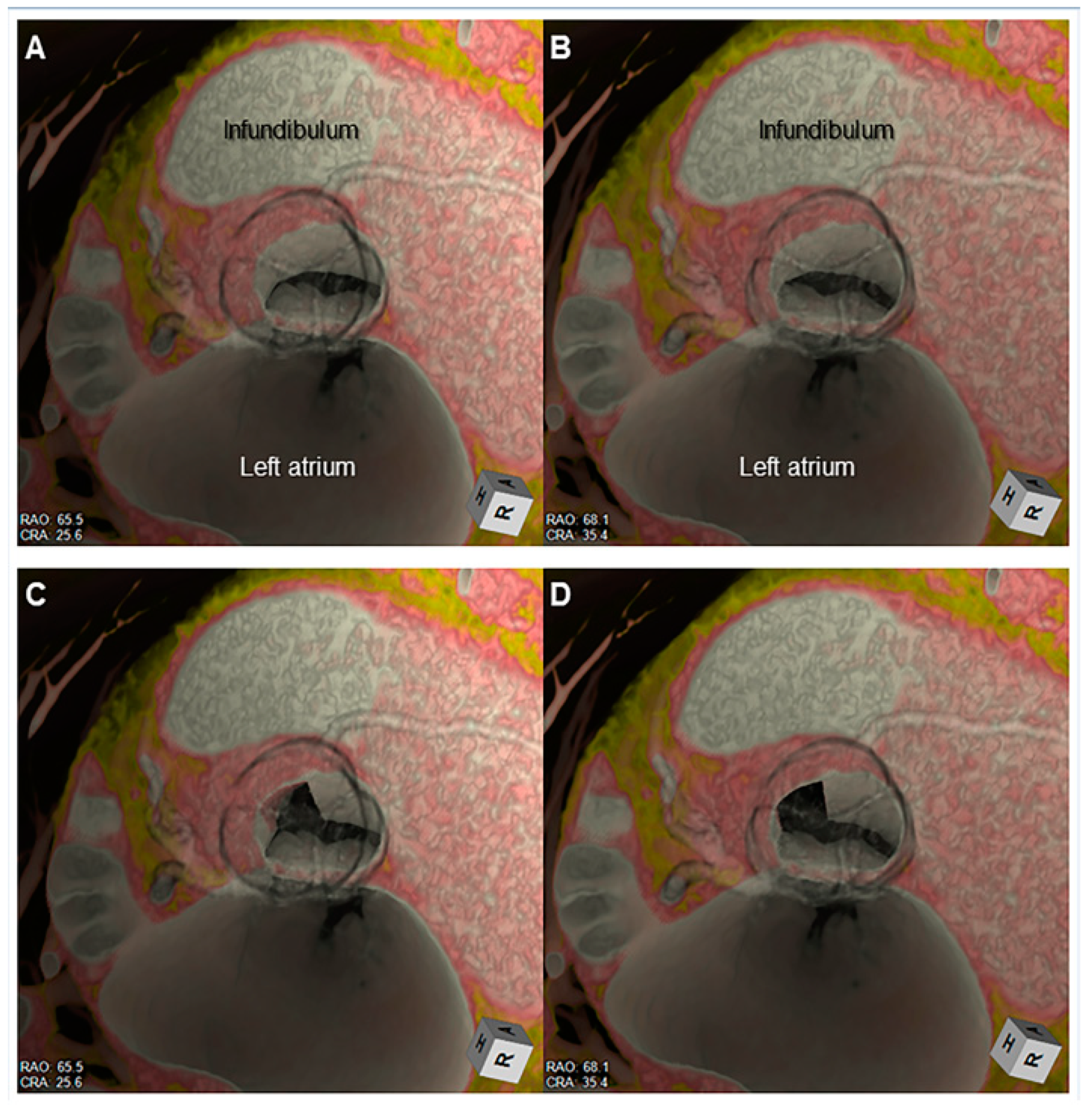 Jcdd 07 00030 g012 Jcdd 07 00030 g012