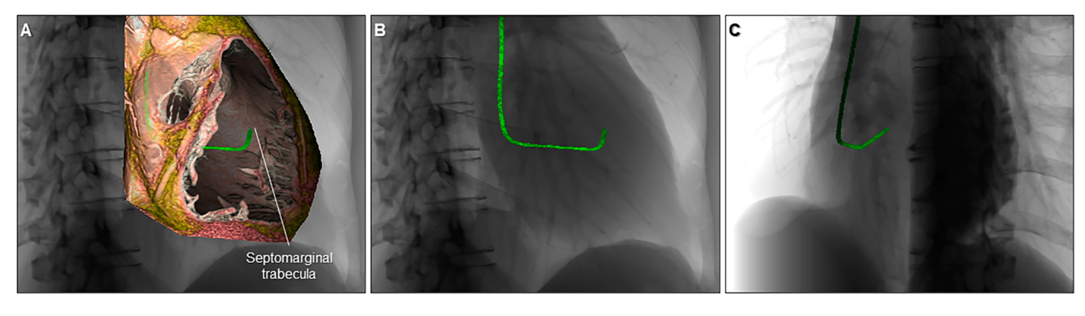 Jcdd 07 00030 g018 Jcdd 07 00030 g018