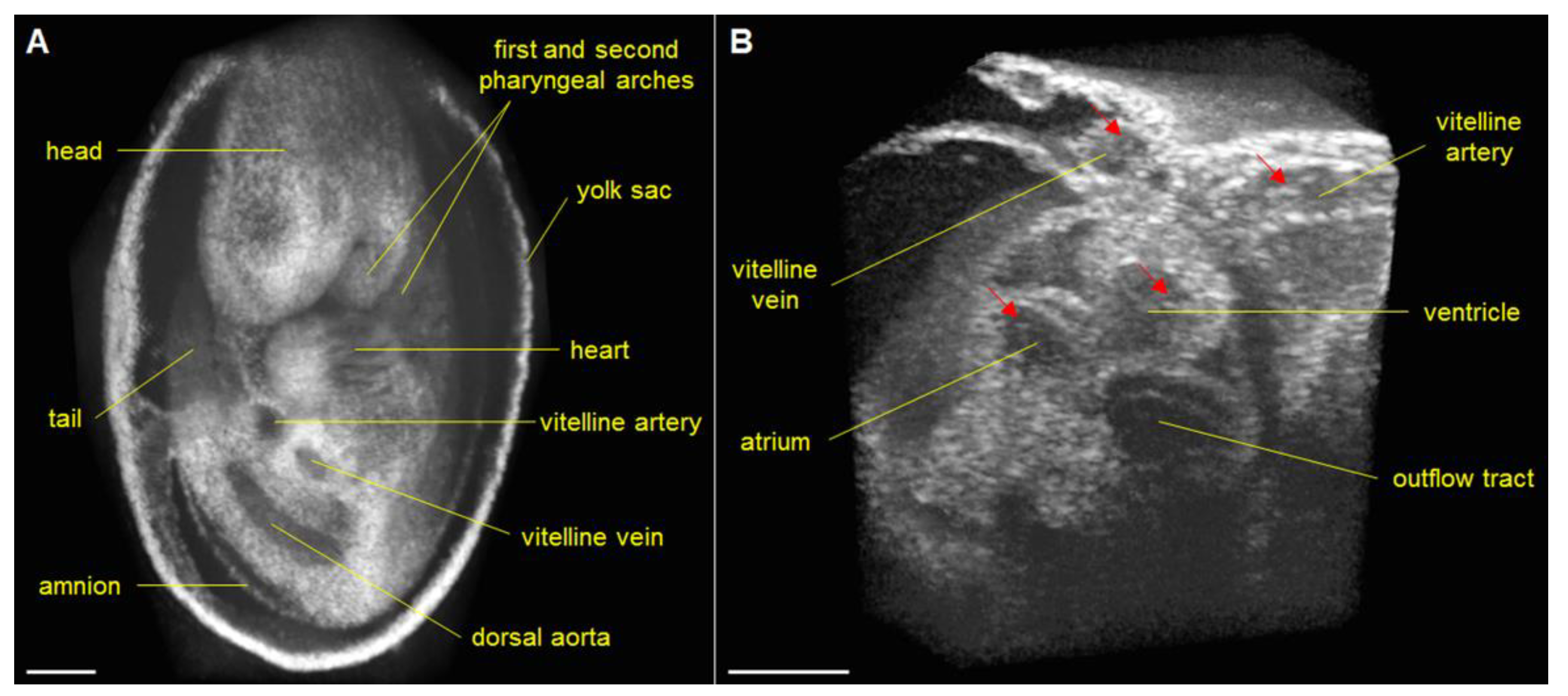 Jcdd 07 00042 g004 Jcdd 07 00042 g004