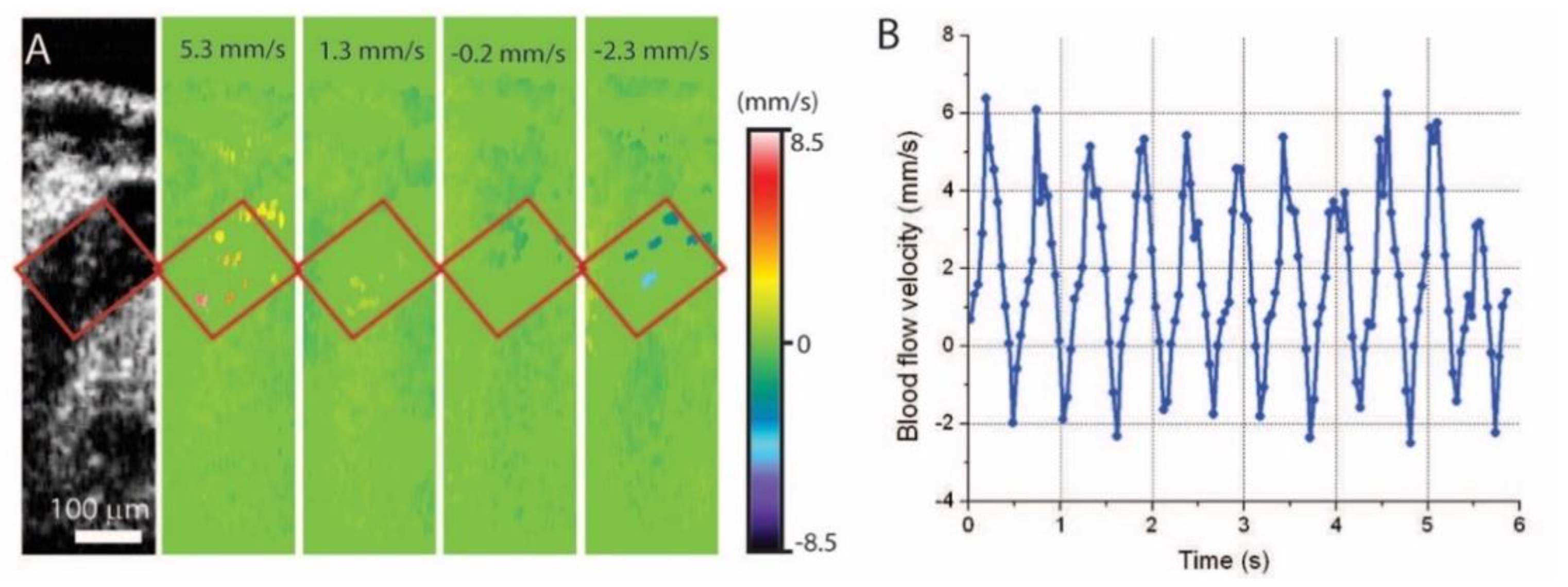 Jcdd 07 00042 g006 Jcdd 07 00042 g006