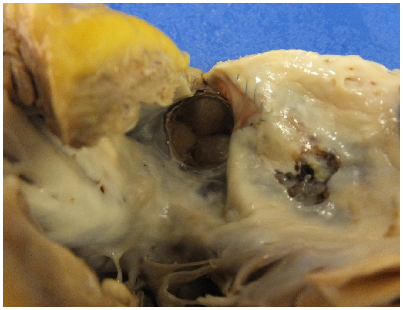 Jcdd 07 00058 g002 Jcdd 07 00058 g002