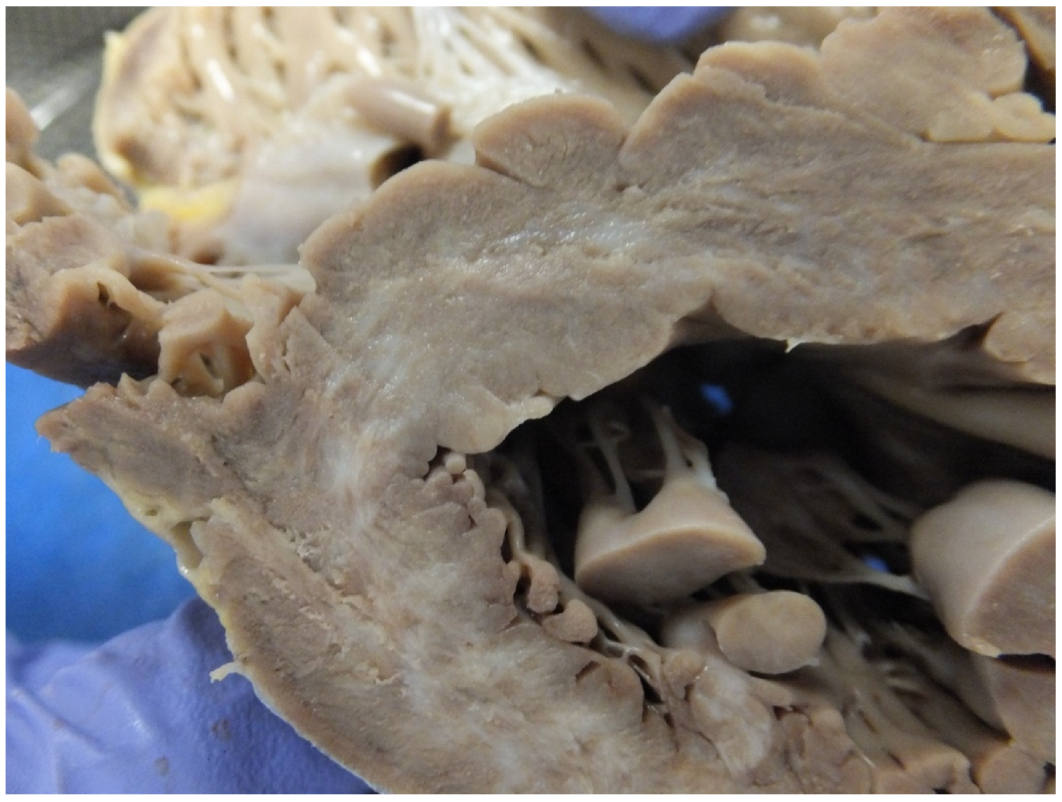 Jcdd 07 00058 g003 Jcdd 07 00058 g003