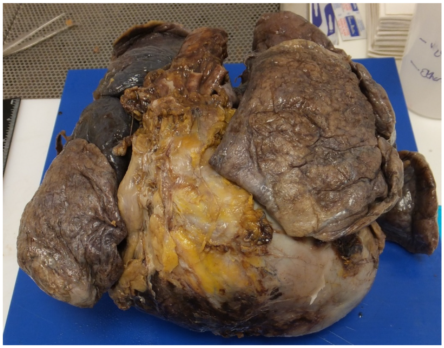 Jcdd 07 00058 g004 Jcdd 07 00058 g004