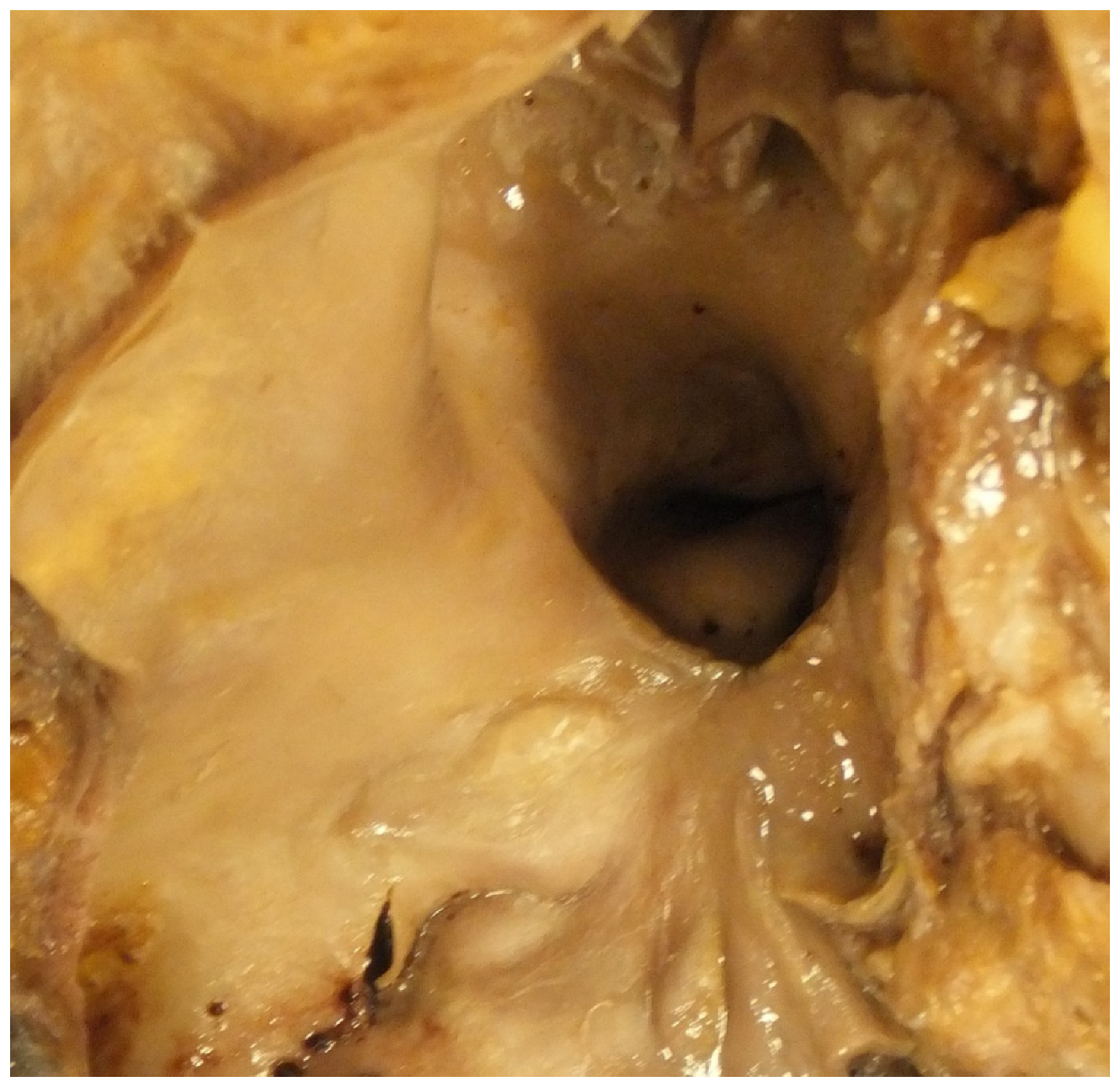 Jcdd 07 00058 g005 Jcdd 07 00058 g005