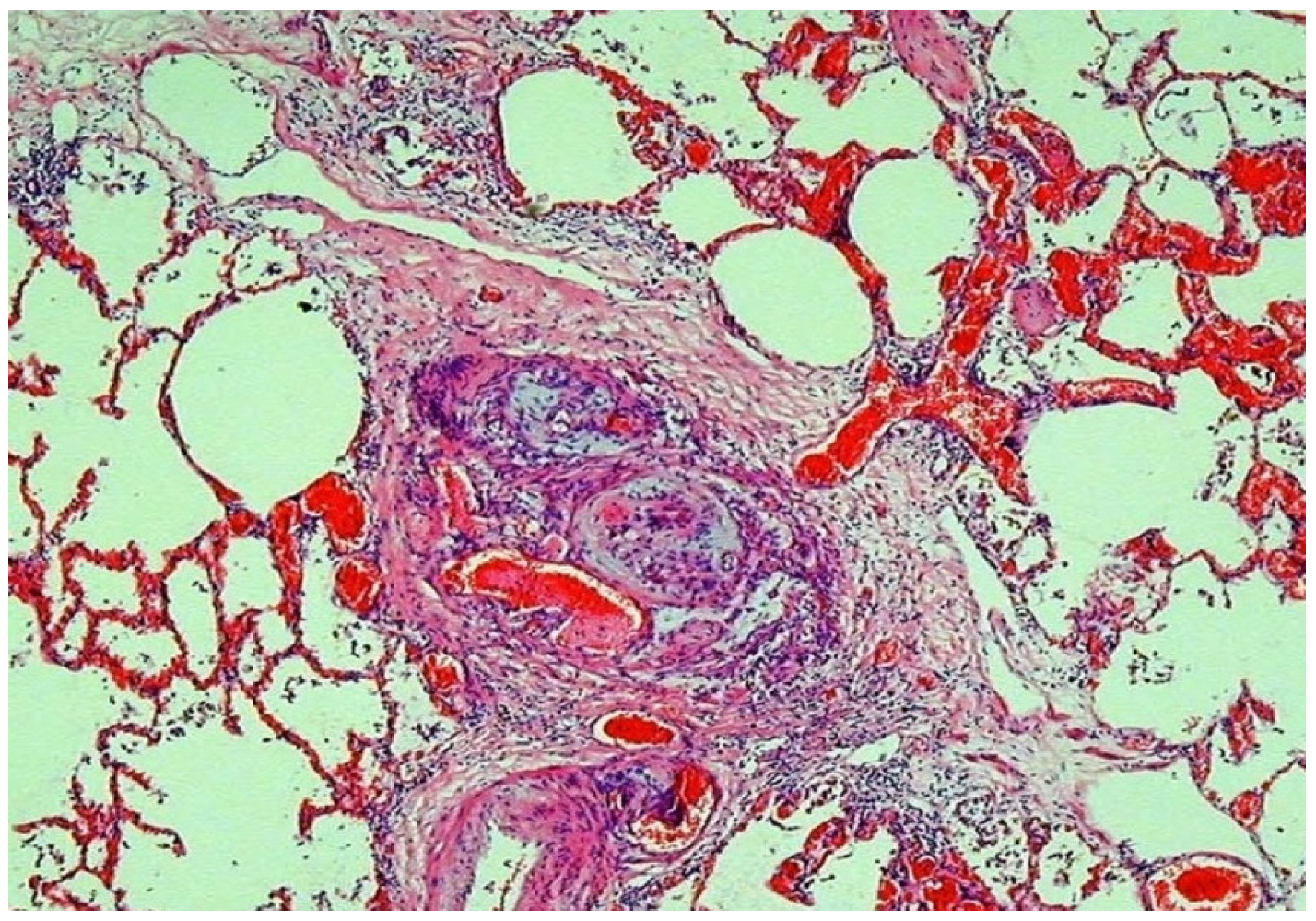 Jcdd 07 00058 g006 Jcdd 07 00058 g006