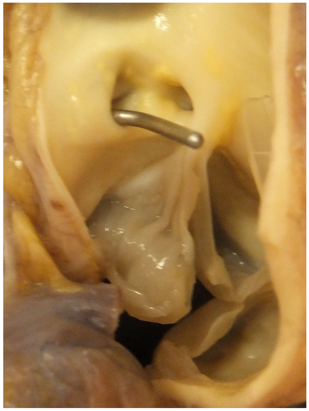 Jcdd 07 00058 g007 Jcdd 07 00058 g007