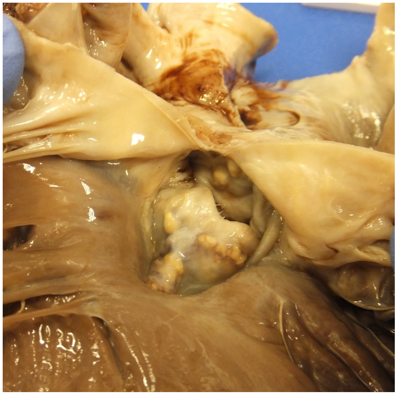 Jcdd 07 00058 g008 Jcdd 07 00058 g008