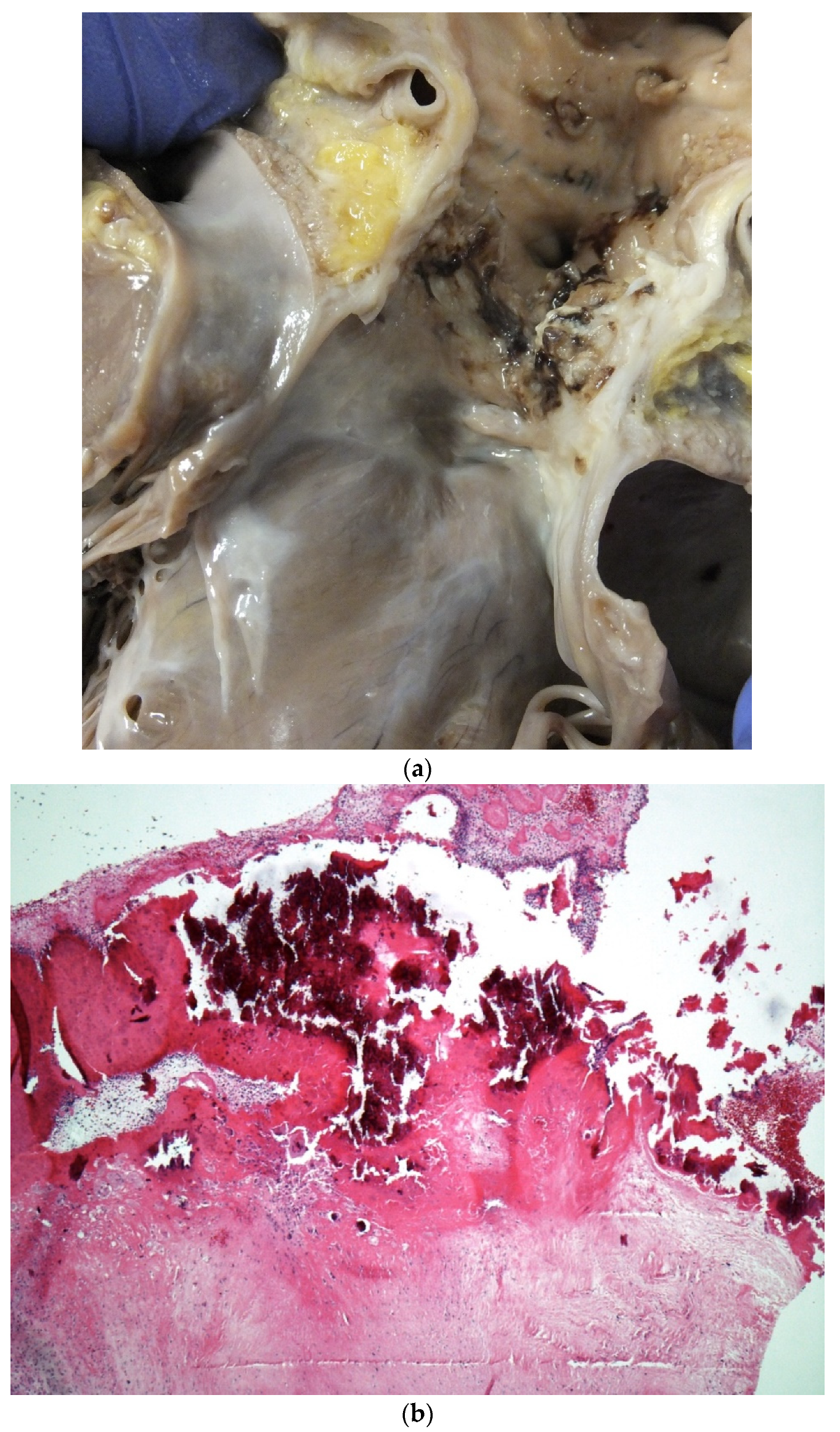 Jcdd 07 00058 g009 Jcdd 07 00058 g009