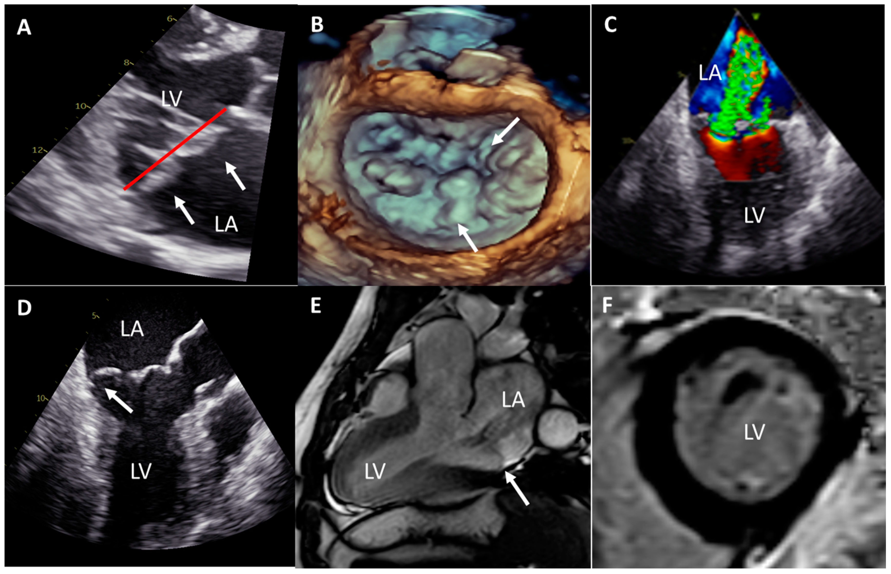 Jcdd 08 00002 g002 Jcdd 08 00002 g002