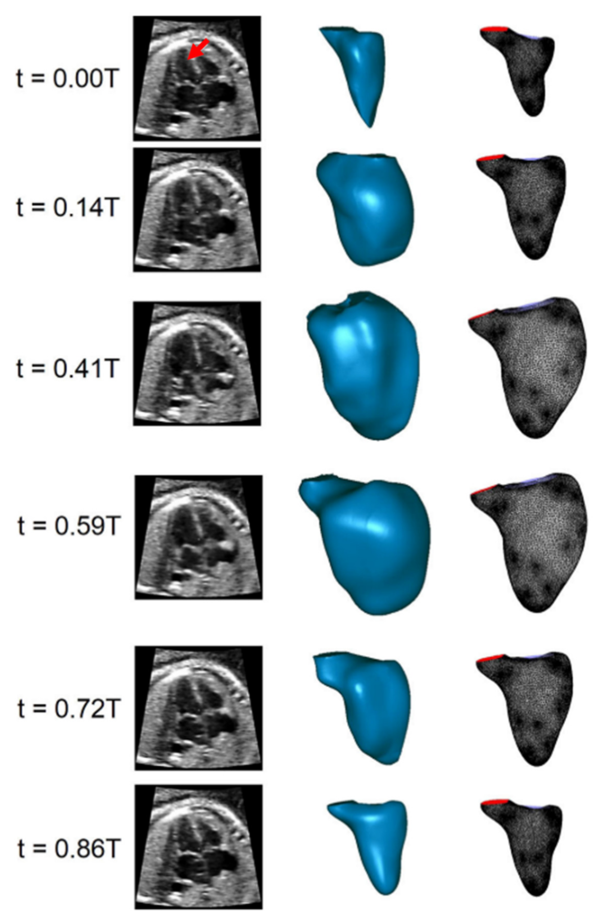 Jcdd 08 00014 g006 Jcdd 08 00014 g006