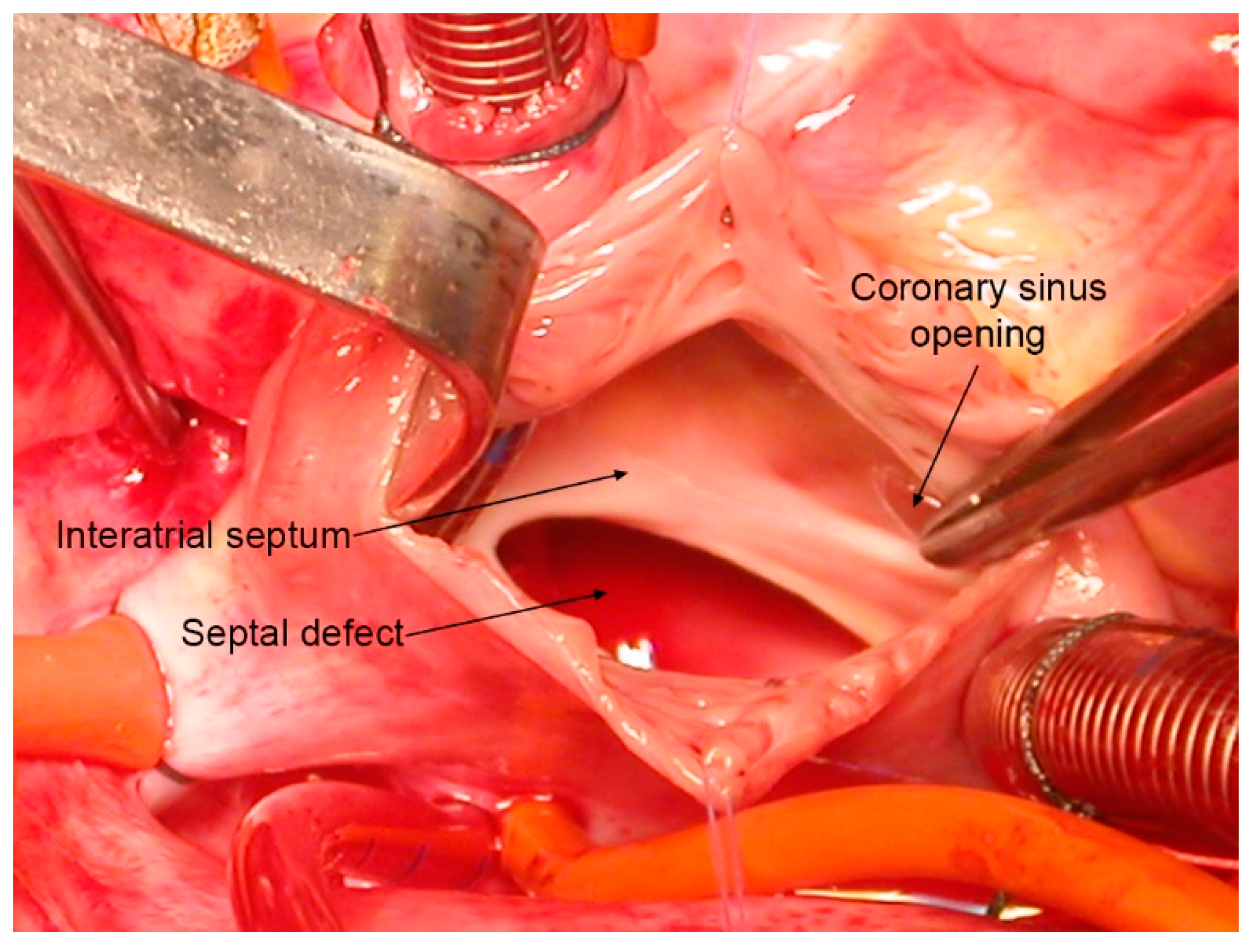 Jcdd 08 00060 g002 Jcdd 08 00060 g002
