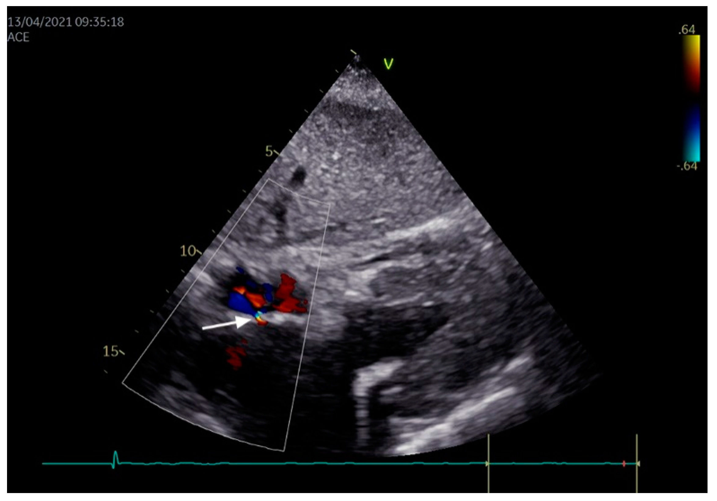 Jcdd 08 00060 g003 Jcdd 08 00060 g003