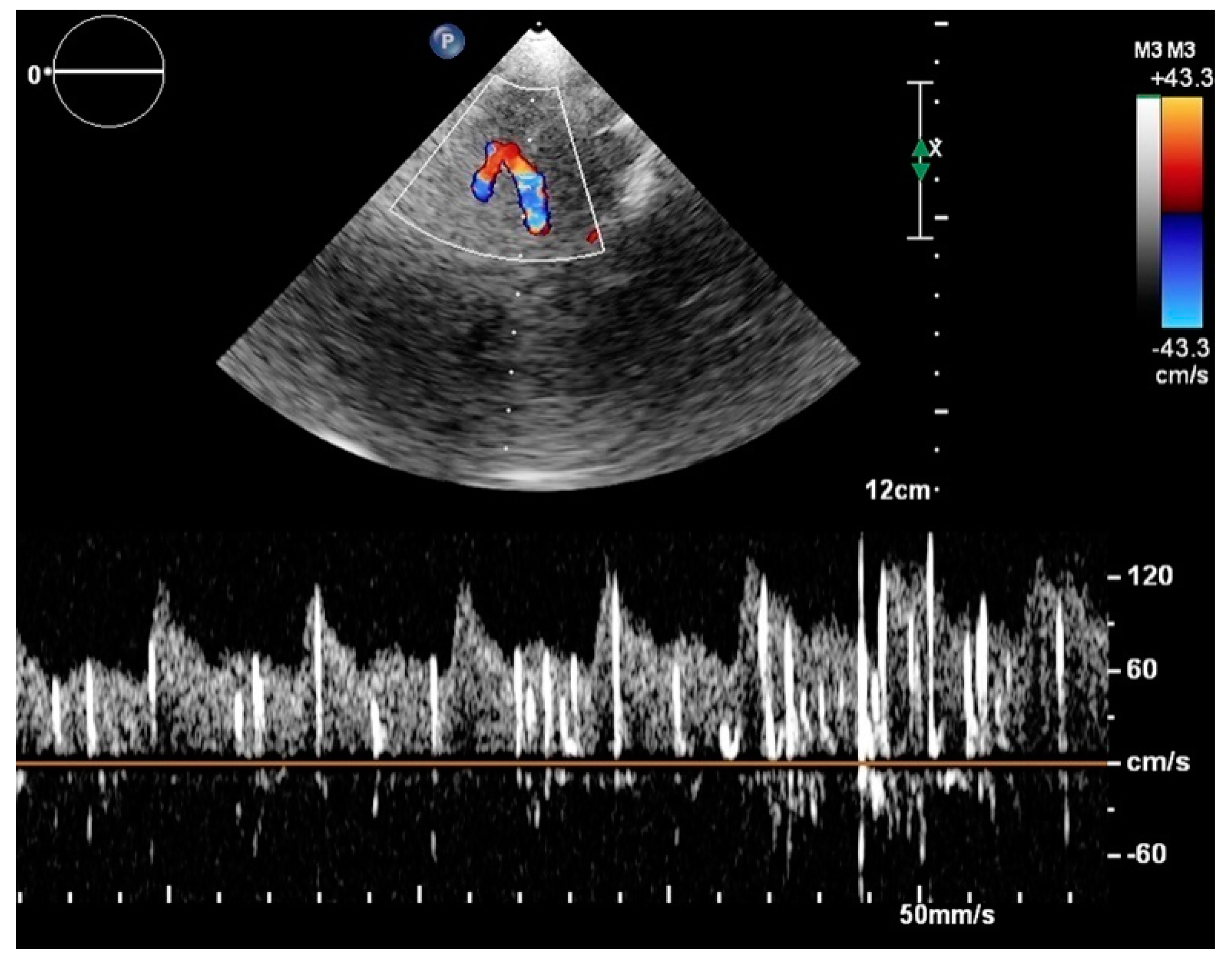 Jcdd 08 00060 g004 Jcdd 08 00060 g004
