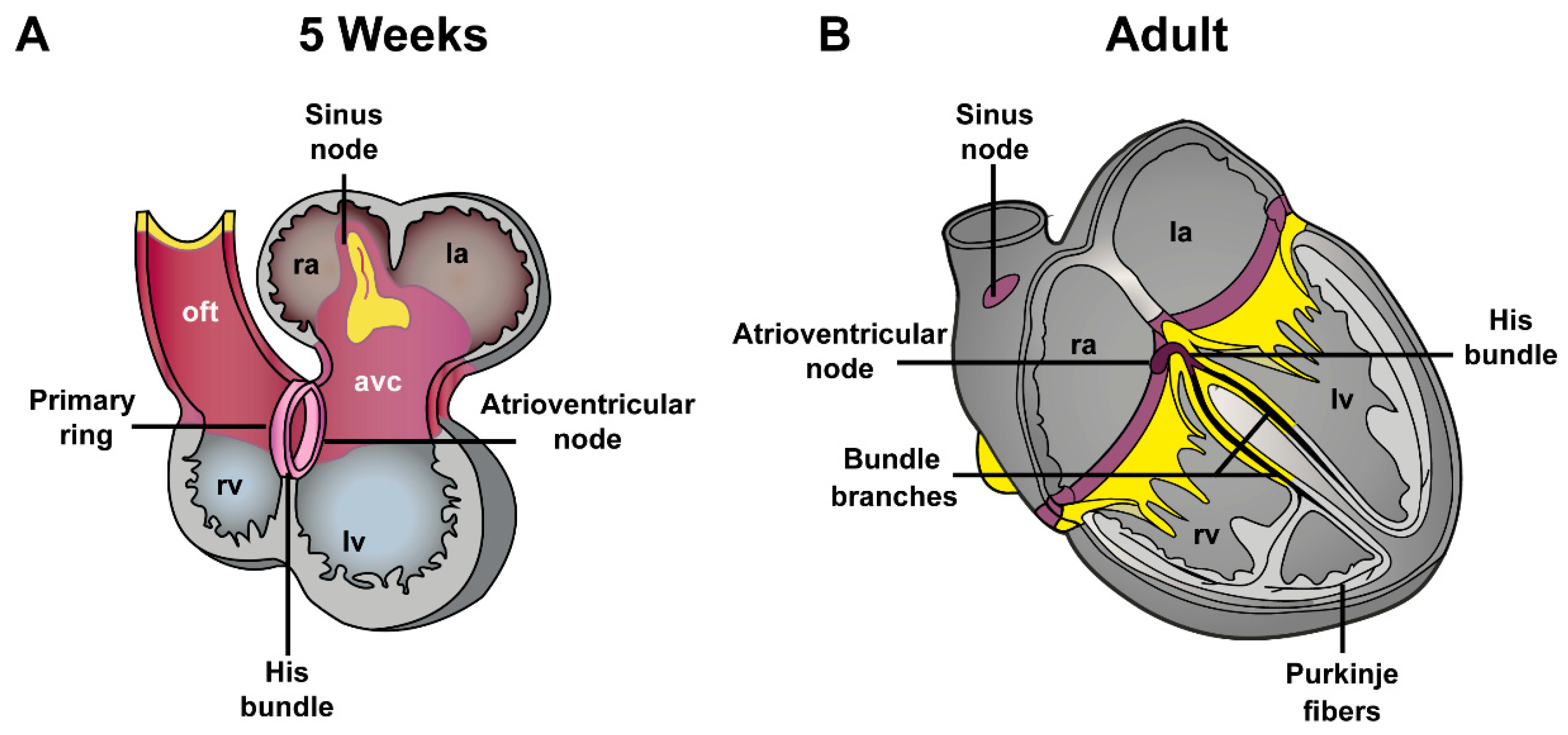 JCDD Free FullText How Cardiac Embryology Translates into Clinical