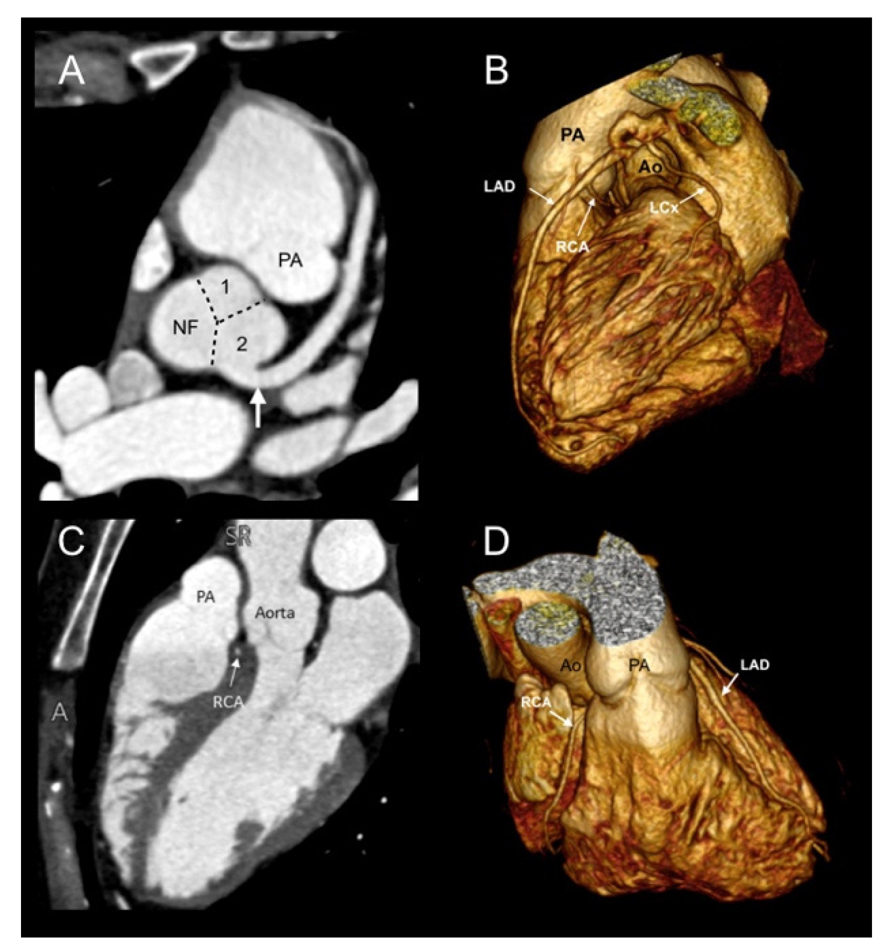 Jcdd 08 00093 g003 550